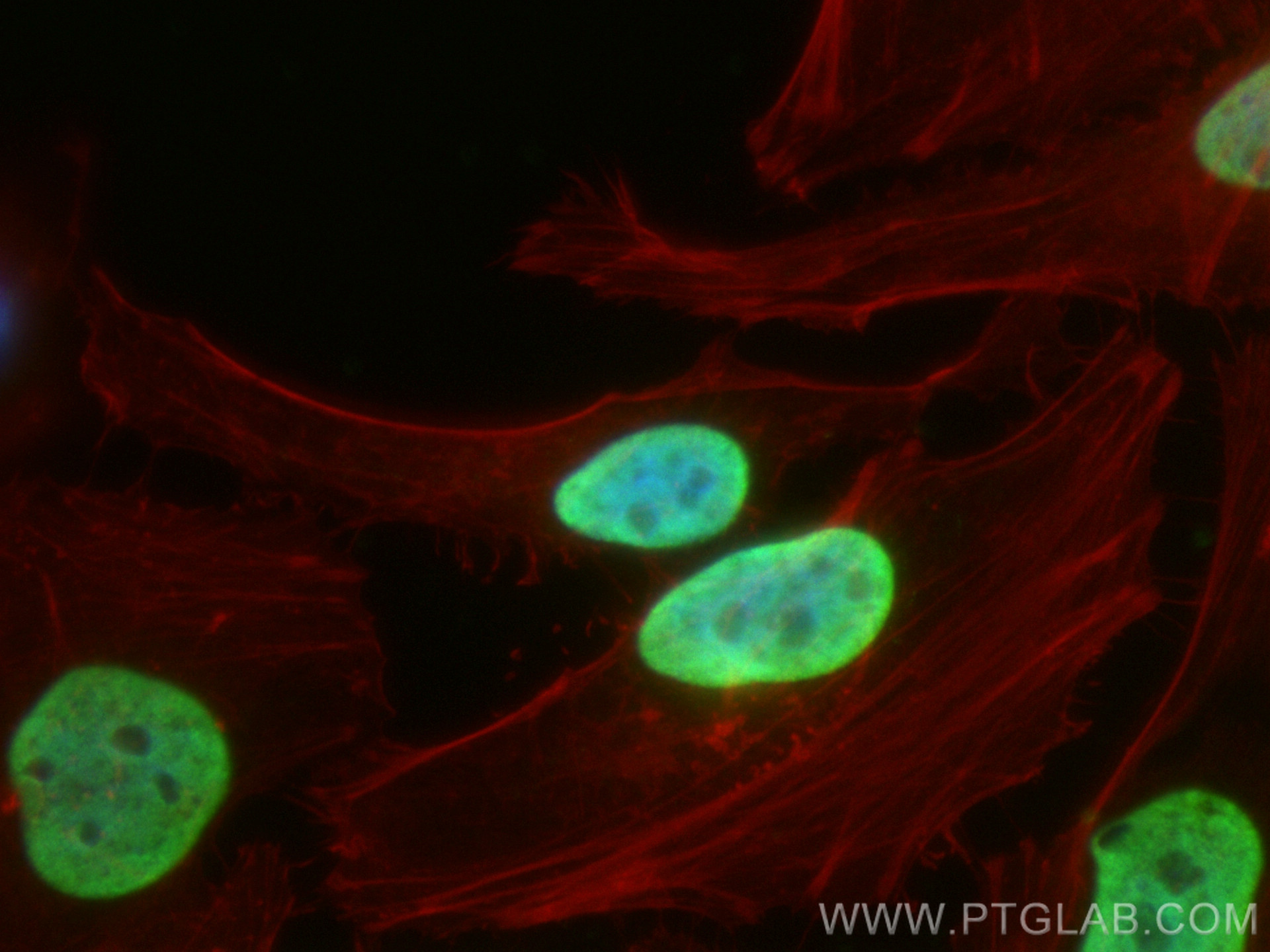 IF Staining of HeLa using 68345-1-Ig