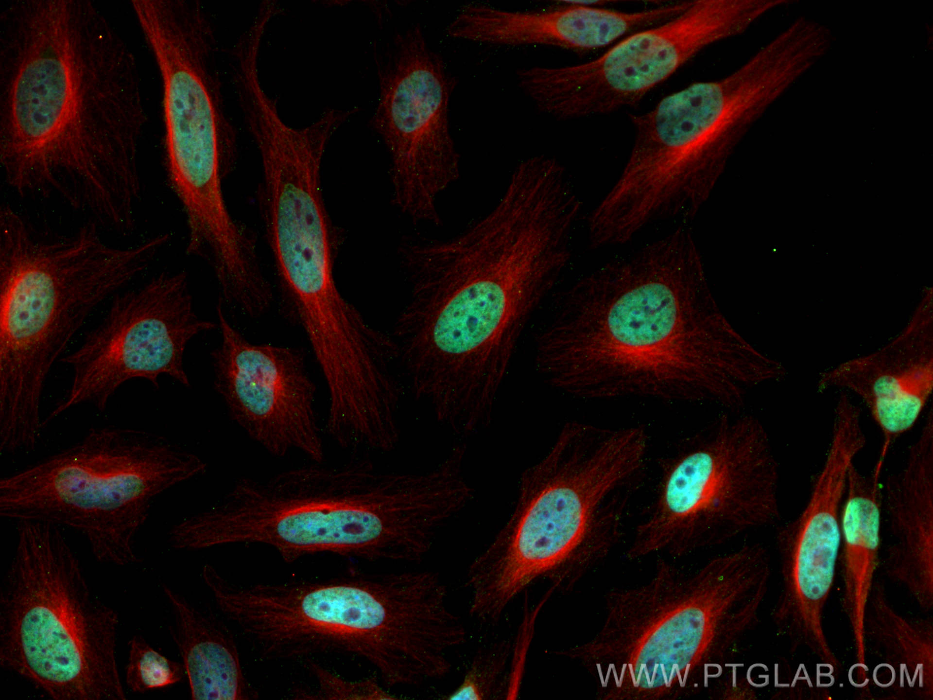 IF Staining of HeLa using 68345-1-Ig (same clone as 68345-1-PBS)