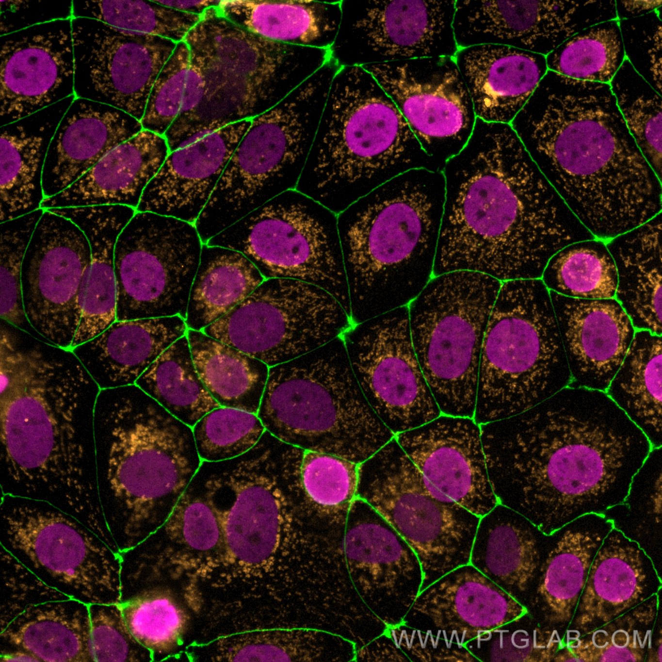 IF Staining of MCF-7 using 68345-1-Ig (same clone as 68345-1-PBS)