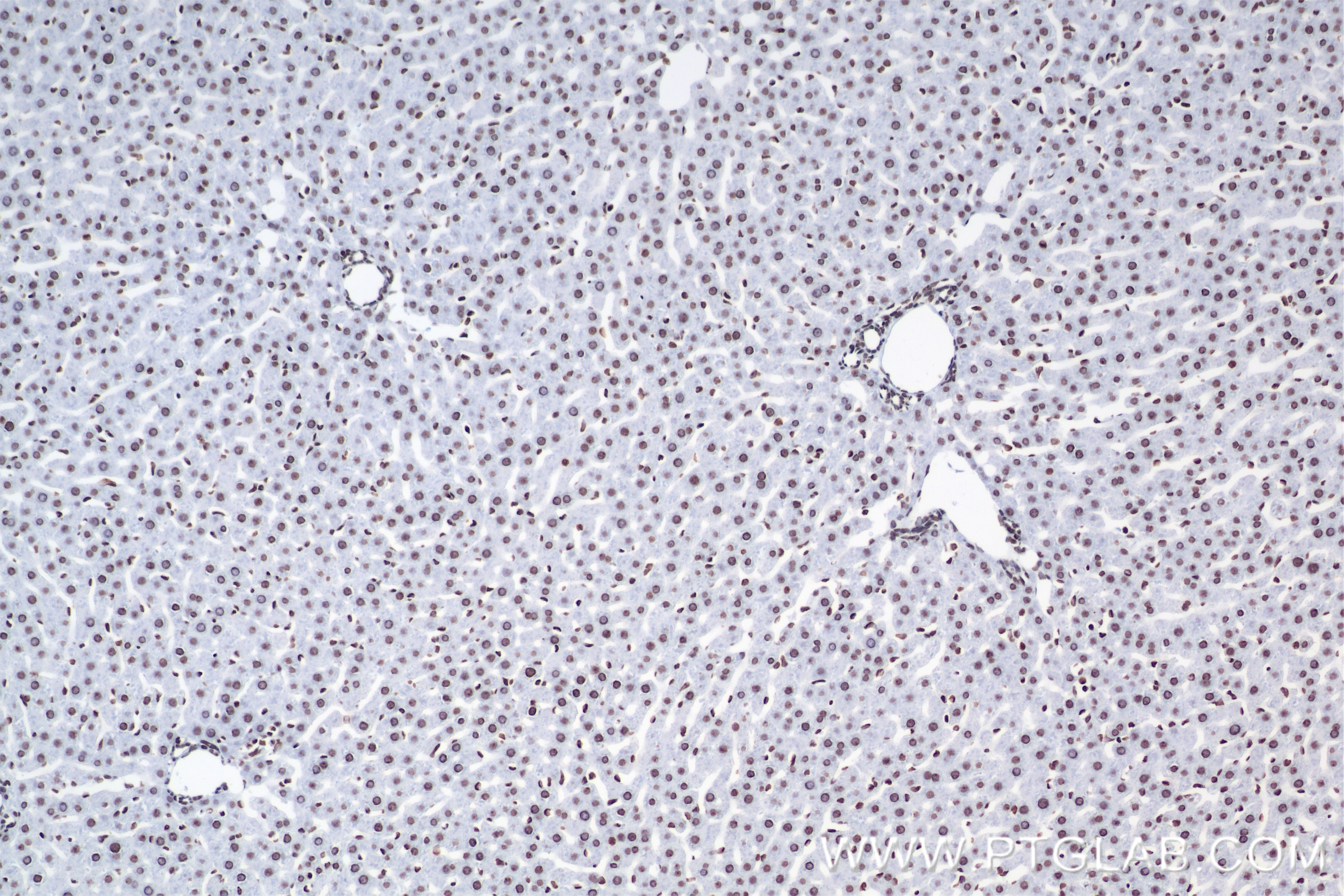 IHC staining of rat liver using 82807-2-RR
