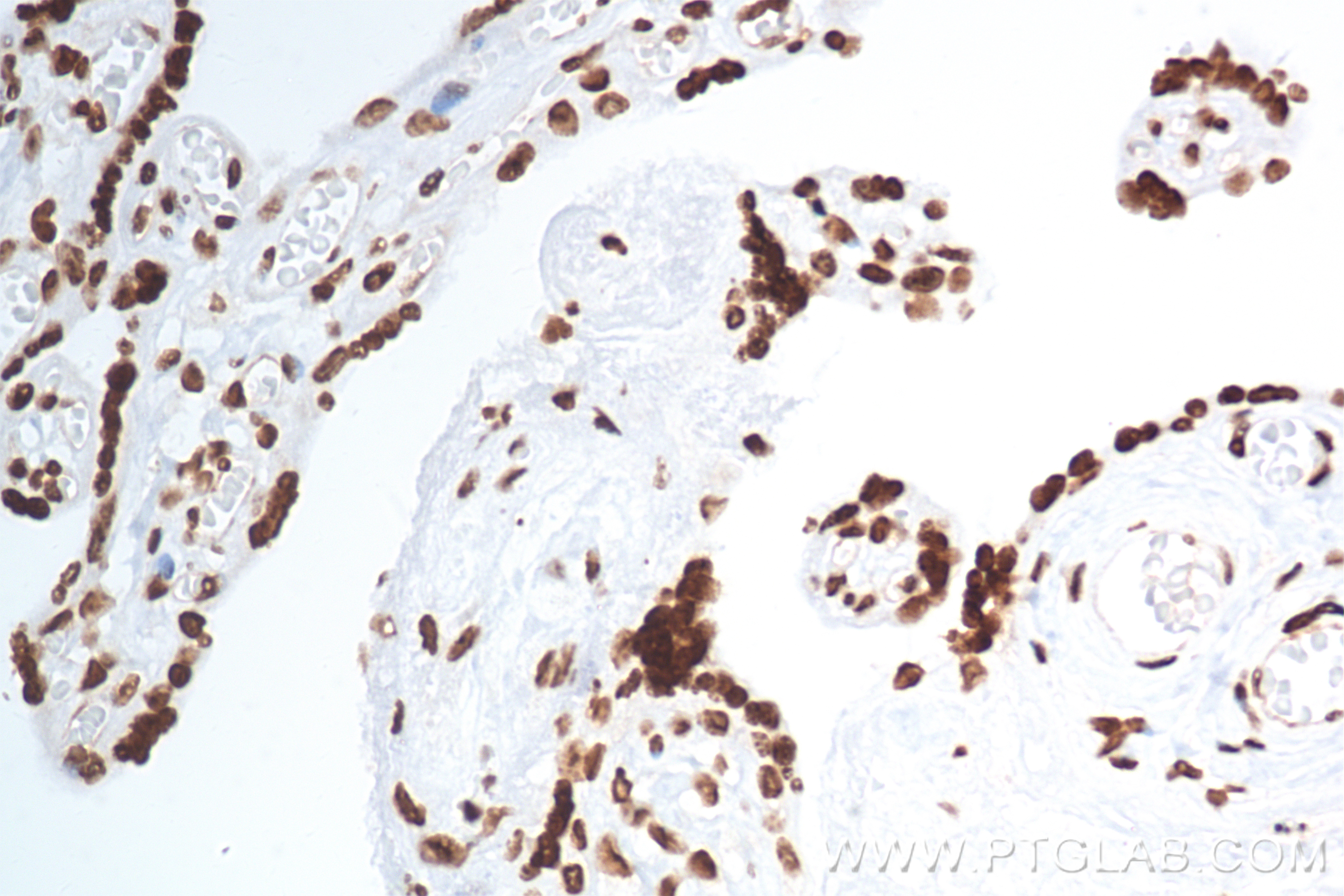 IHC staining of human placenta using 82807-2-RR