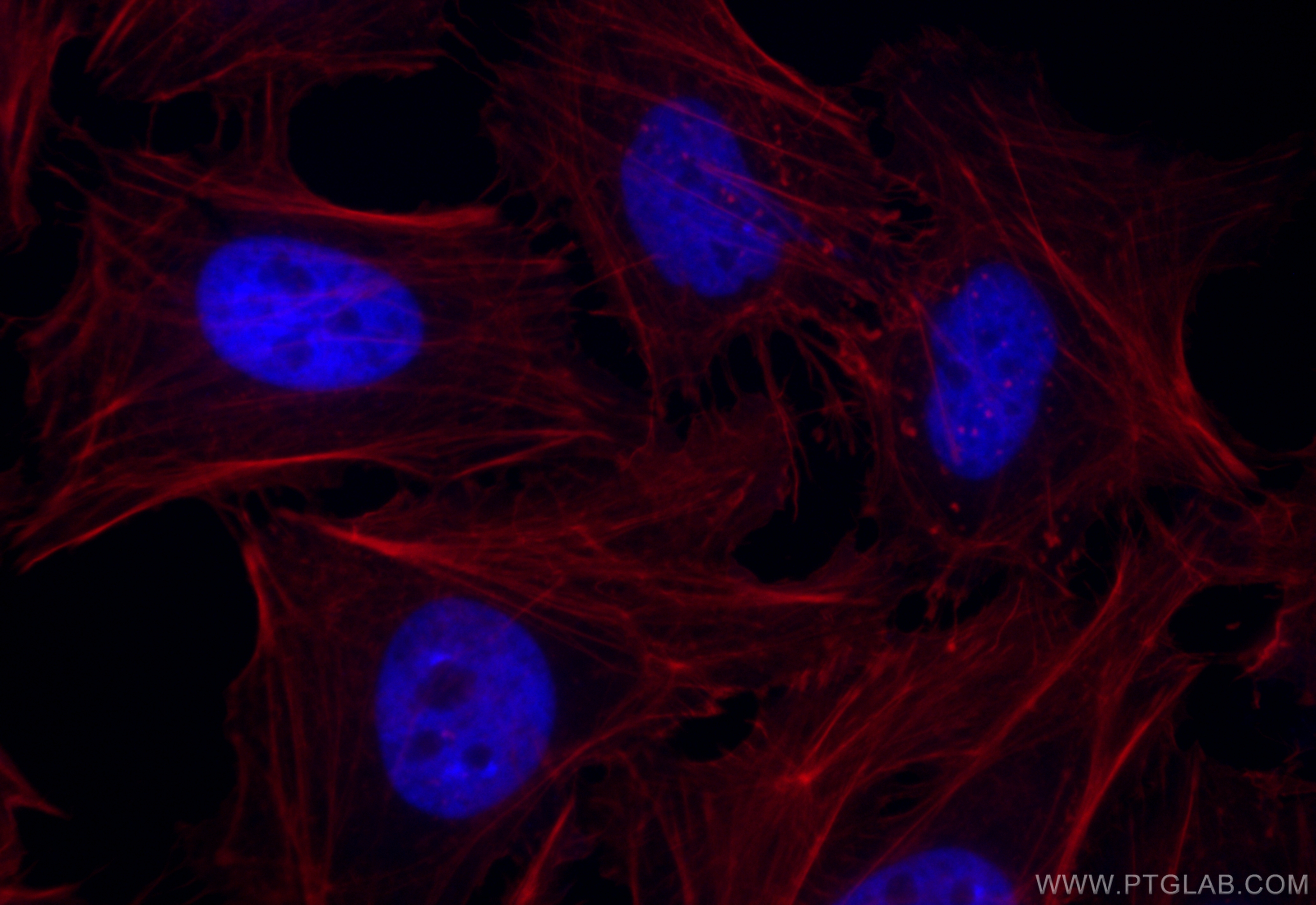 IF Staining of HeLa using CL405-68345