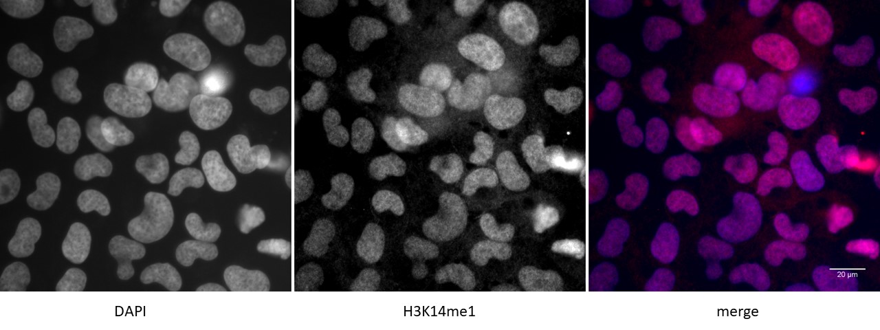 Detection of H3K4me1 by immunofluorescence U2OS cells were stained with H3K4me1 antibody at a dilution of 1:500. Left panel: DAPI. Middle panel: H3K4me1 antibody staining. Right panel: merge.
