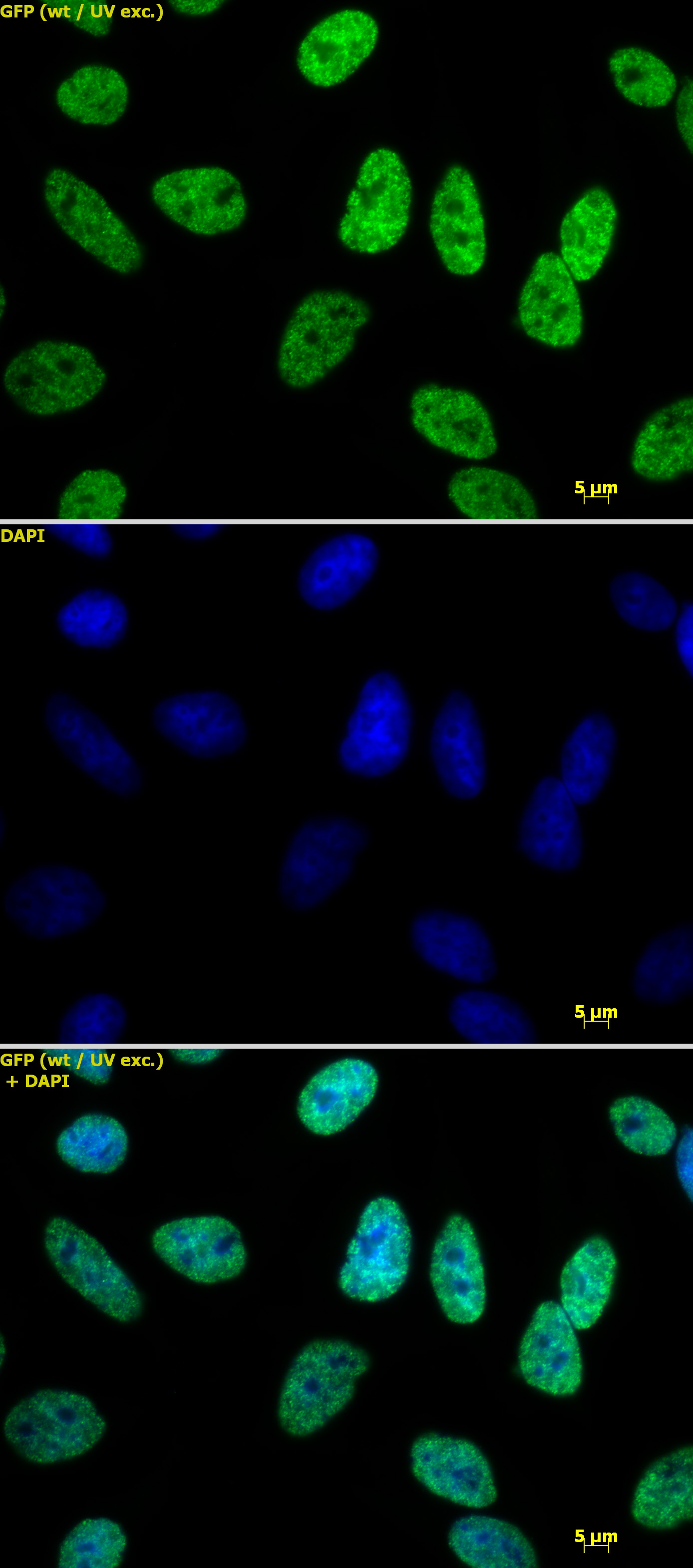 Histone H3 acetyl Lys18 antibody tested by immunofluorescence. Detection of Histone H3 acetyl Lys18 by immunofluorescence. HeLa cells were stained with Histone H3 acetyl Lys18 antibody at a dilution of 1 ug/ml. Top panel: Histone H3 acetyl Lys18 antibody staining. Middle panel: DAPI. Bottom panel: merge.