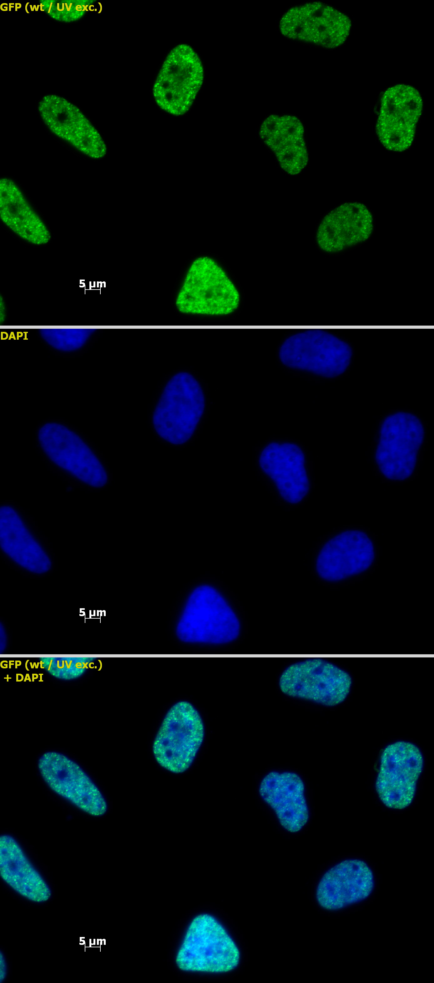 Histone H3 acetyl Lys27 mAb tested by immunofluorescence. Staining of HeLa cells with Histone H3 acetyl Lys27 mAb (1 ug/ml, top panel) and DAPI (middle panel), and a merge of both images (bottom panel).