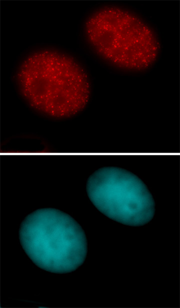 Histone H3 acetyl Lys27 antibody tested by immunofluorescence. Staining of HEK293 cells with Histone H3 acetyl Lys27 antibody (1 ug/ml dilution, top panel) and DAPI (bottom panel). Histone H3 acetyl Lys27 antibody tested by immunofluorescence. Staining of HEK293 cells with Histone H3 acetyl Lys27 antibody (1 ug/ml dilution, top panel) and DAPI (bottom panel).