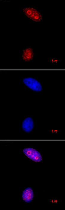 Histone H3K27me3 pAb tested by immunofluorescence. HeLa cells stained with Histone H3 trimethyl Lys27 antibody (1.7 ug/ml dilution). Top panel: Histone H3 trimethyl Lys27 antibody. Middle: DAPI. Bottom: Merge of both images.