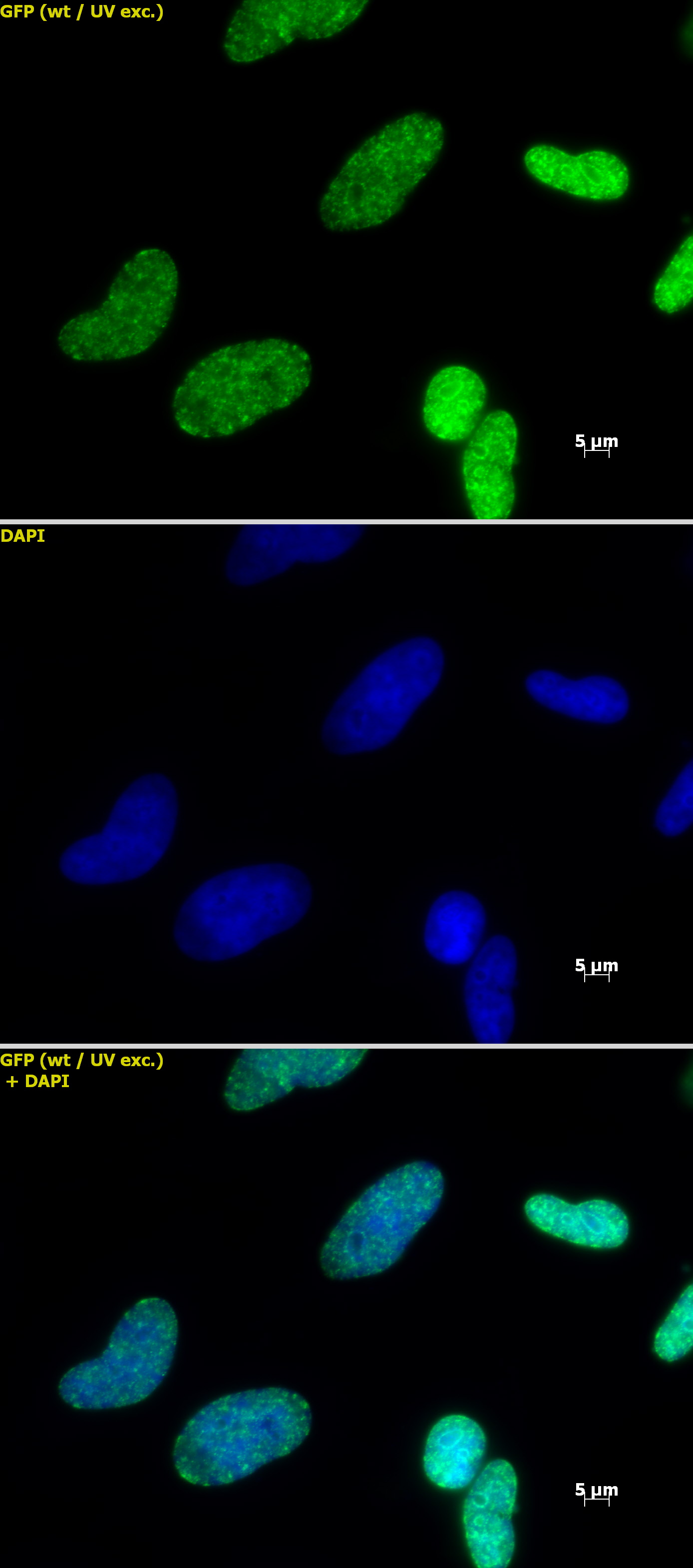 Histone H3K27me3 antibody (pAb) tested by immunofluorescence. Staining of HeLa cells with Histone H3 trimethyl Lys27 antibody (1:1,000, top panel) and DAPI (middle panel), and a merge of both images (bottom panel). Histone H3K27me3 antibody (pAb) tested by immunofluorescence. Staining of HeLa cells with Histone H3 trimethyl Lys27 antibody (1:1,000, top panel) and DAPI (middle panel), and a merge of both images (bottom panel).