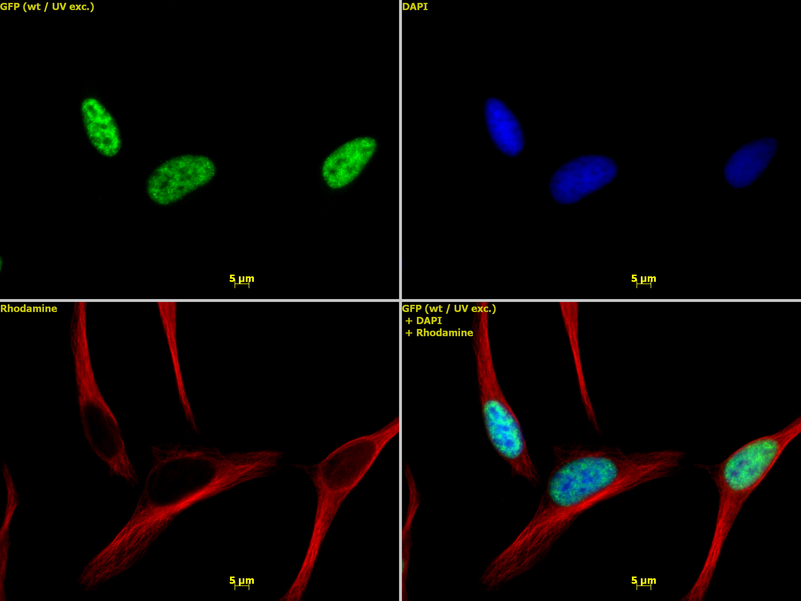 Histone H3 trimethyl Lys4 antibody tested by immunofluorescence. HeLa cells stained at 1:1,000 with Histone H3 trimethyl Lys4 antibody. Top left: Histone H3 trimethyl Lys4 antibody.Top right: Stained with DAPI. Bottom left: Same cells stained with alpha Tubulin mAb (Clone 5-B-1-2). Bottom right: Merge of all 3 images. Histone H3 trimethyl Lys4 antibody tested by immunofluorescence. HeLa cells stained at 1:1,000 with Histone H3 trimethyl Lys4 antibody. Top left: Histone H3 trimethyl Lys4 antibody.Top right: Stained with DAPI. Bottom left: Same cells stained with alpha Tubulin mAb (Clone 5-B-1-2). Bottom right: Merge of all 3 images.