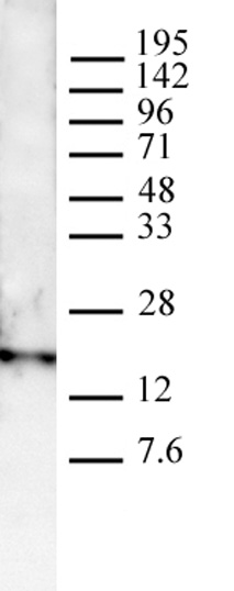Histone H3K4me3 antibody (pAb) tested by Western blot. HeLa nuclear extract (20 ug) was probed with Histone H3K4me3 antibody (pAb) at a 1:1000 dilution. Note: For optimal results, we recommend a High Salt & Sonication Protocol when preparing nuclear extracts. Visit www.activemotif.com to download the protocol. It is also recommended to include 0.05% Tween 20 in all blocking solutions to reduce background. Individual optimization may be required. Histone H3K4me3 antibody (pAb) tested by Western blot. HeLa nuclear extract (20 ug) was probed with Histone H3K4me3 antibody (pAb) at a 1:1000 dilution. Note: For optimal results, we recommend a High Salt & Sonication Protocol when preparing nuclear extracts. Visit www.activemotif.com to download the protocol. It is also recommended to include 0.05% Tween 20 in all blocking solutions to reduce background. Individual optimization may be required.