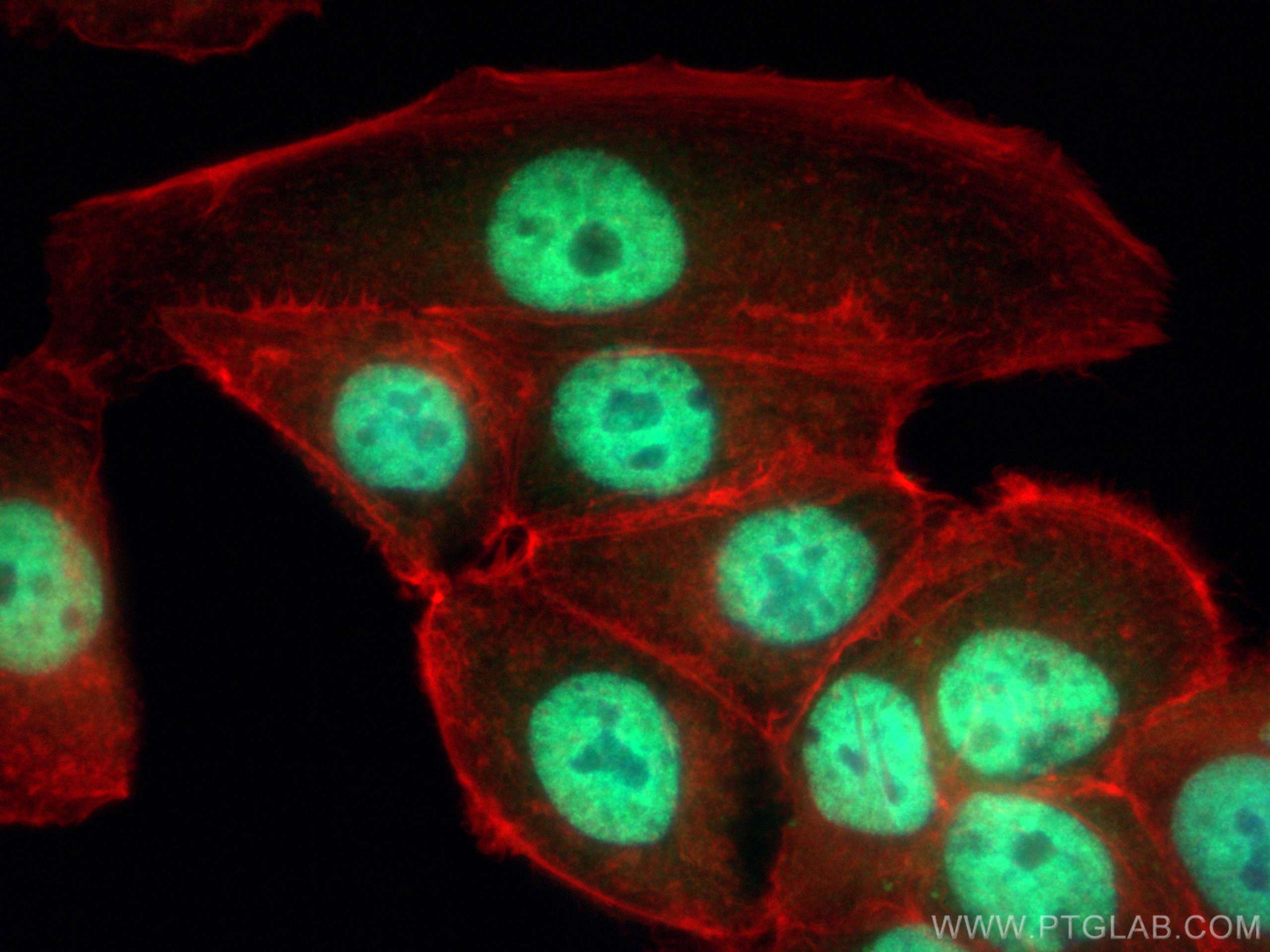 IF Staining of MCF-7 using 11910-1-AP