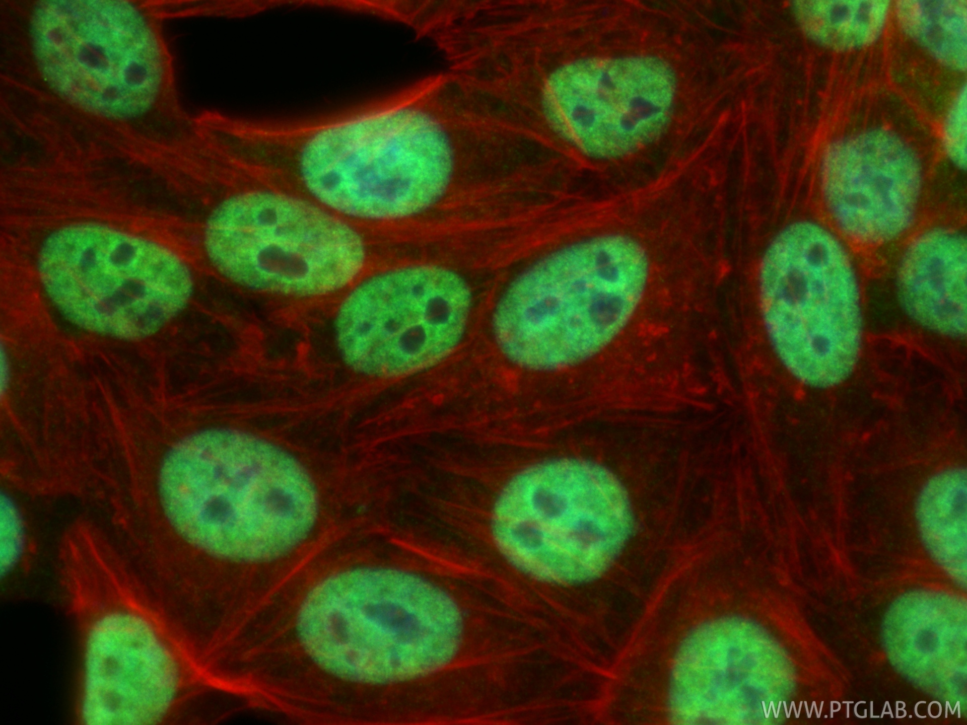 IF Staining of HepG2 using 66549-1-Ig
