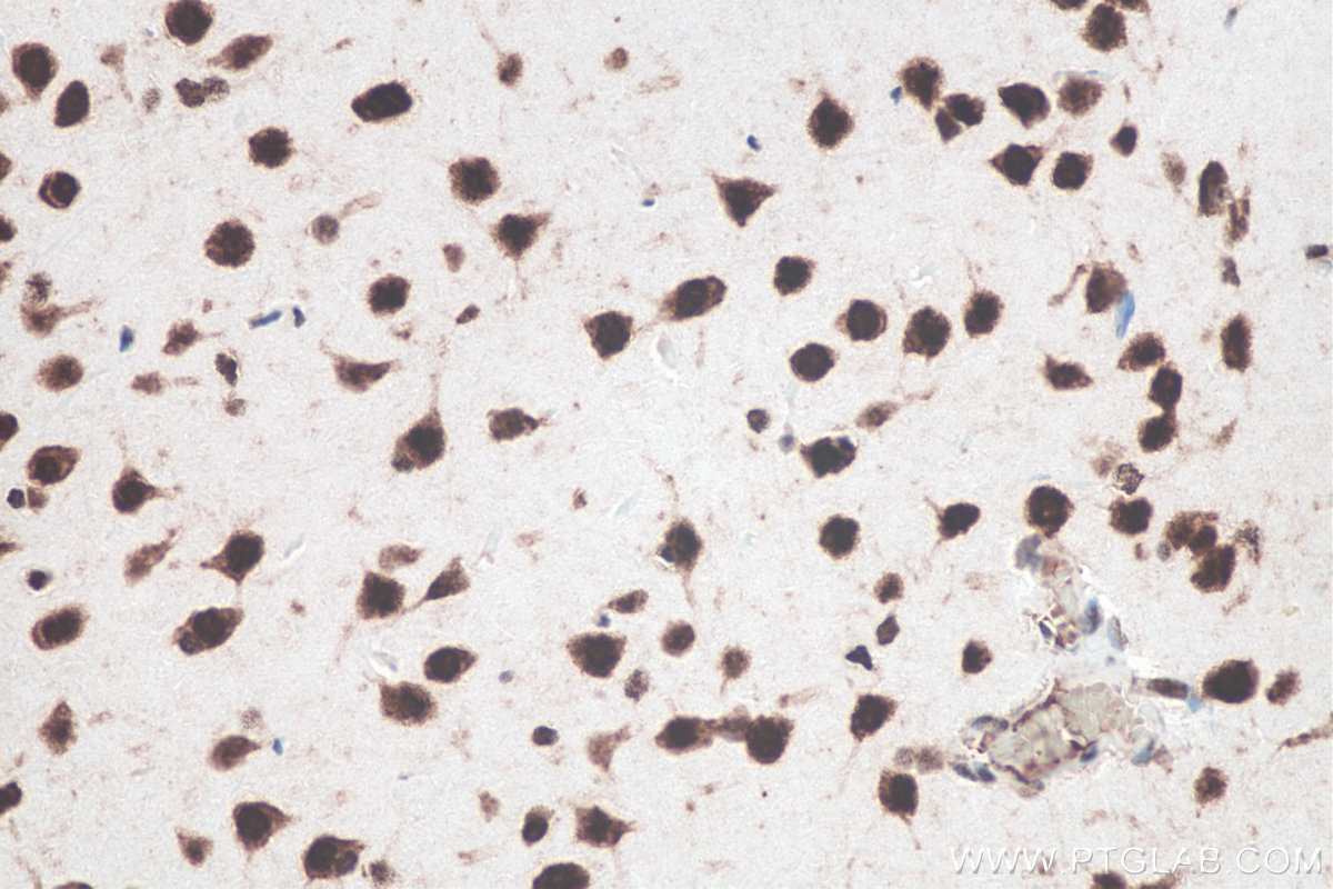 IHC staining of rat brain using 66549-1-Ig IHC staining of rat brain using 66549-1-Ig