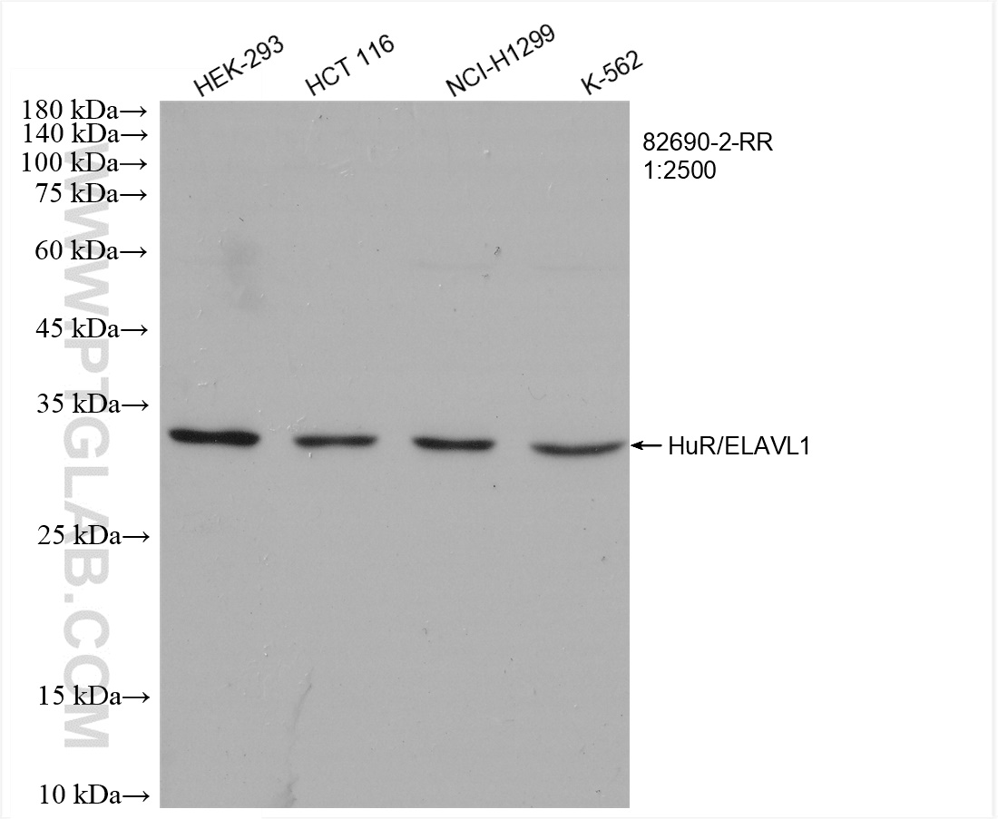 HuR/ELAVL1
