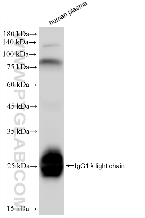 WB analysis of human plasma using 87680-2-RR WB analysis of human plasma using 87680-2-RR
