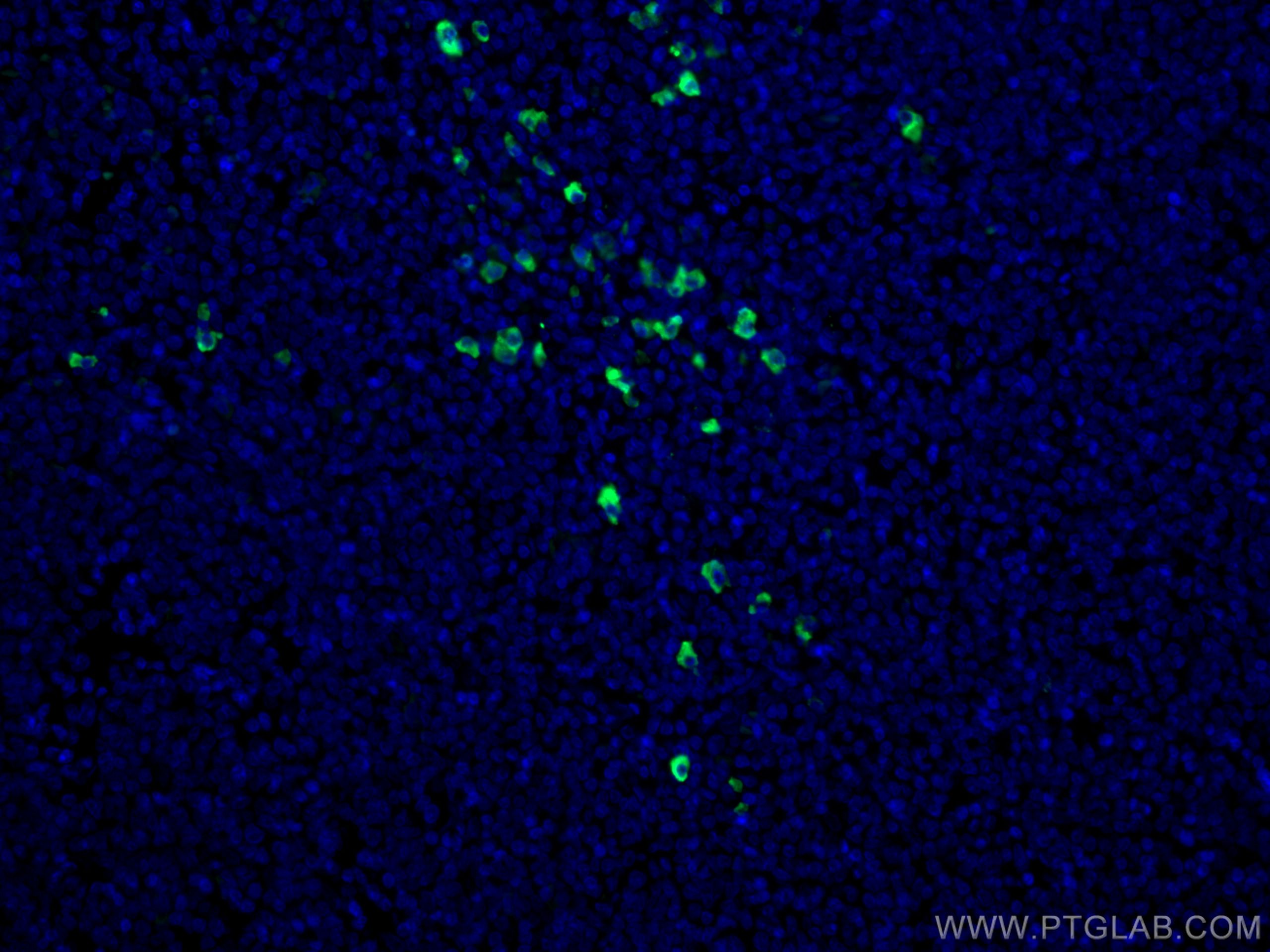 IF Staining of human tonsillitis using CL488-60099