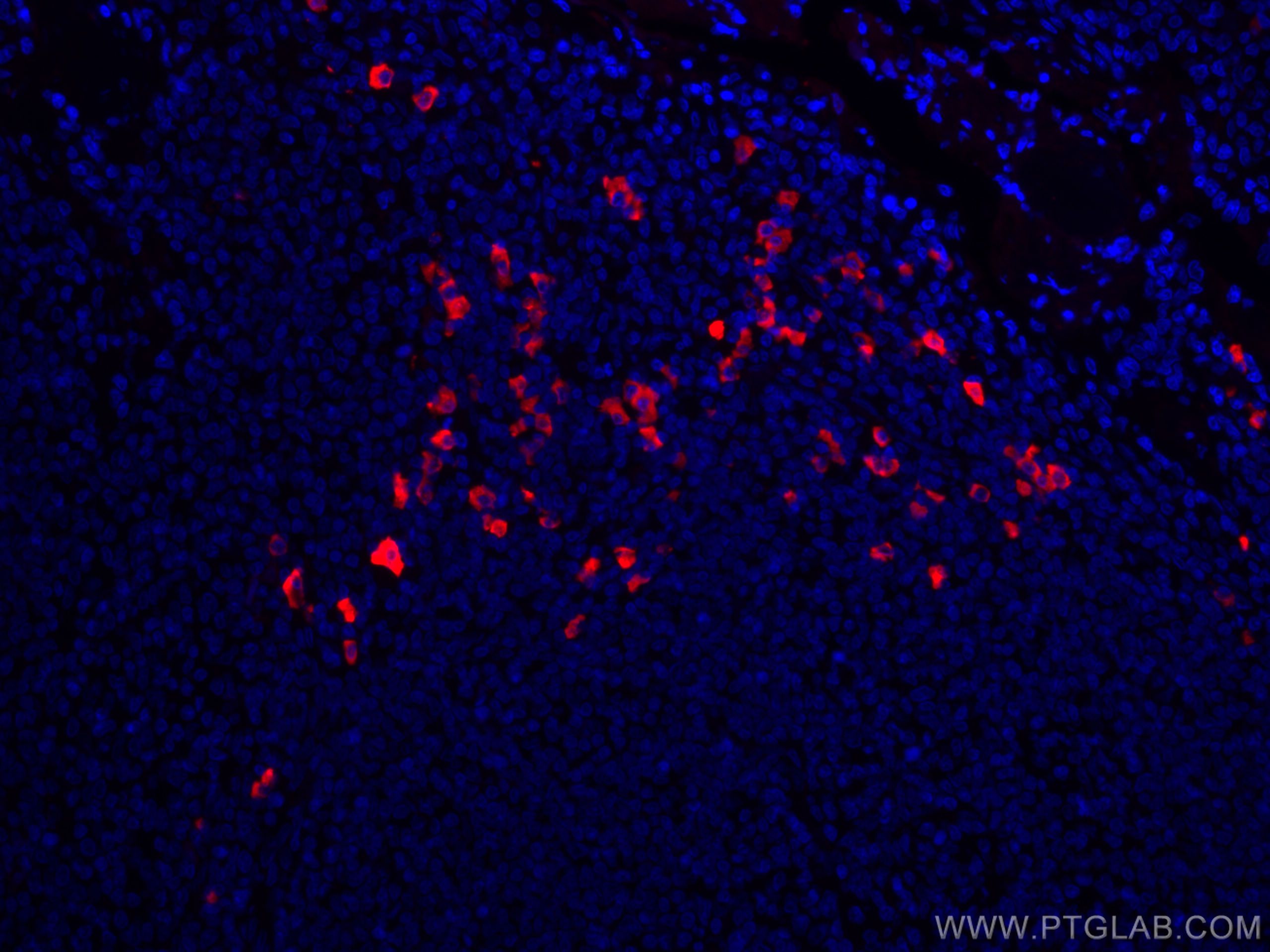 IF Staining of human tonsillitis using CL594-60099