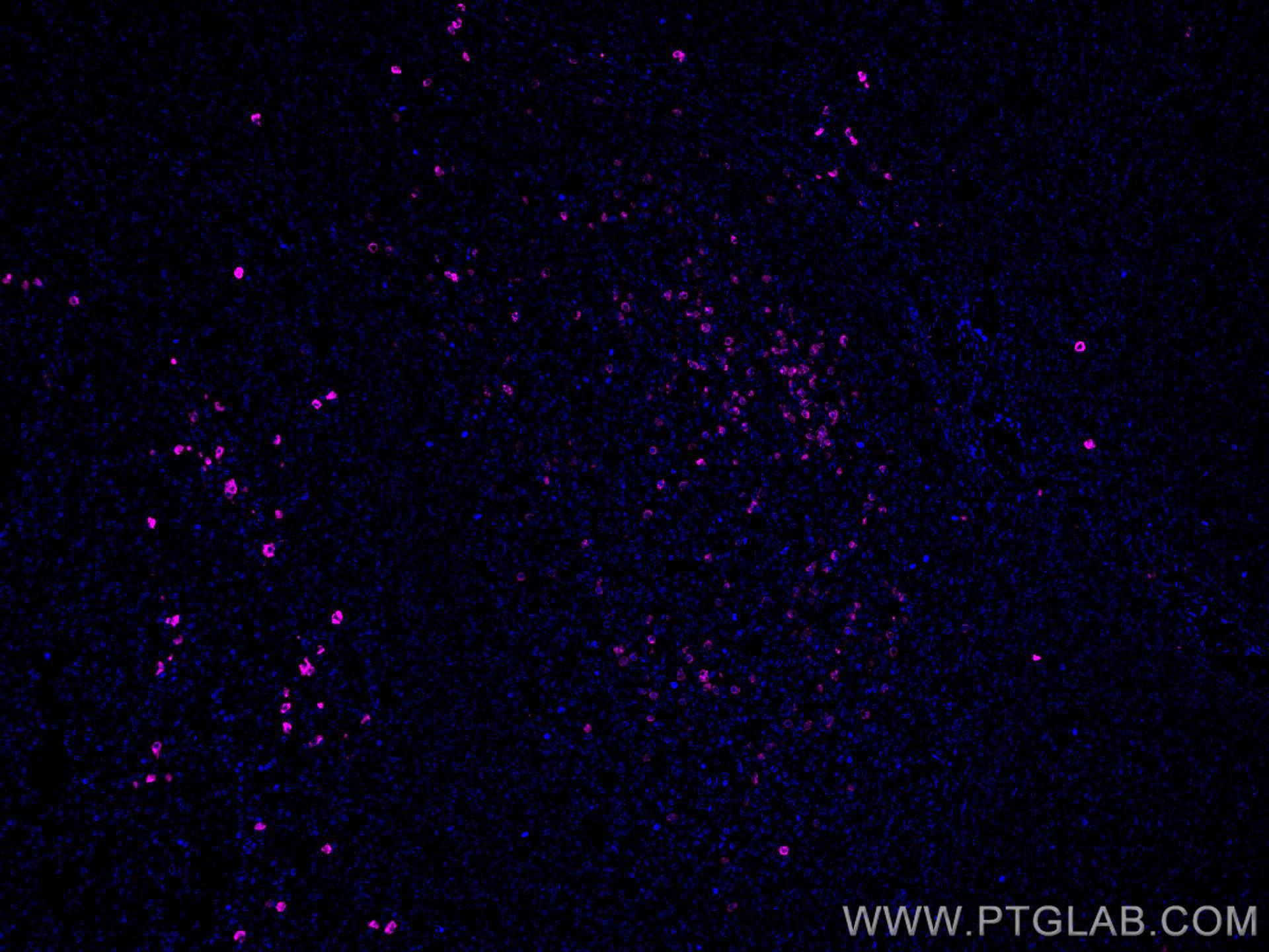 IF Staining of human tonsillitis using CL647-60099