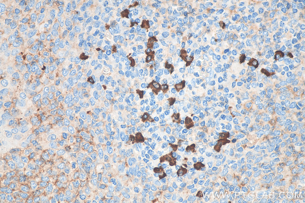 IHC staining of human tonsillitis using Biotin-11449