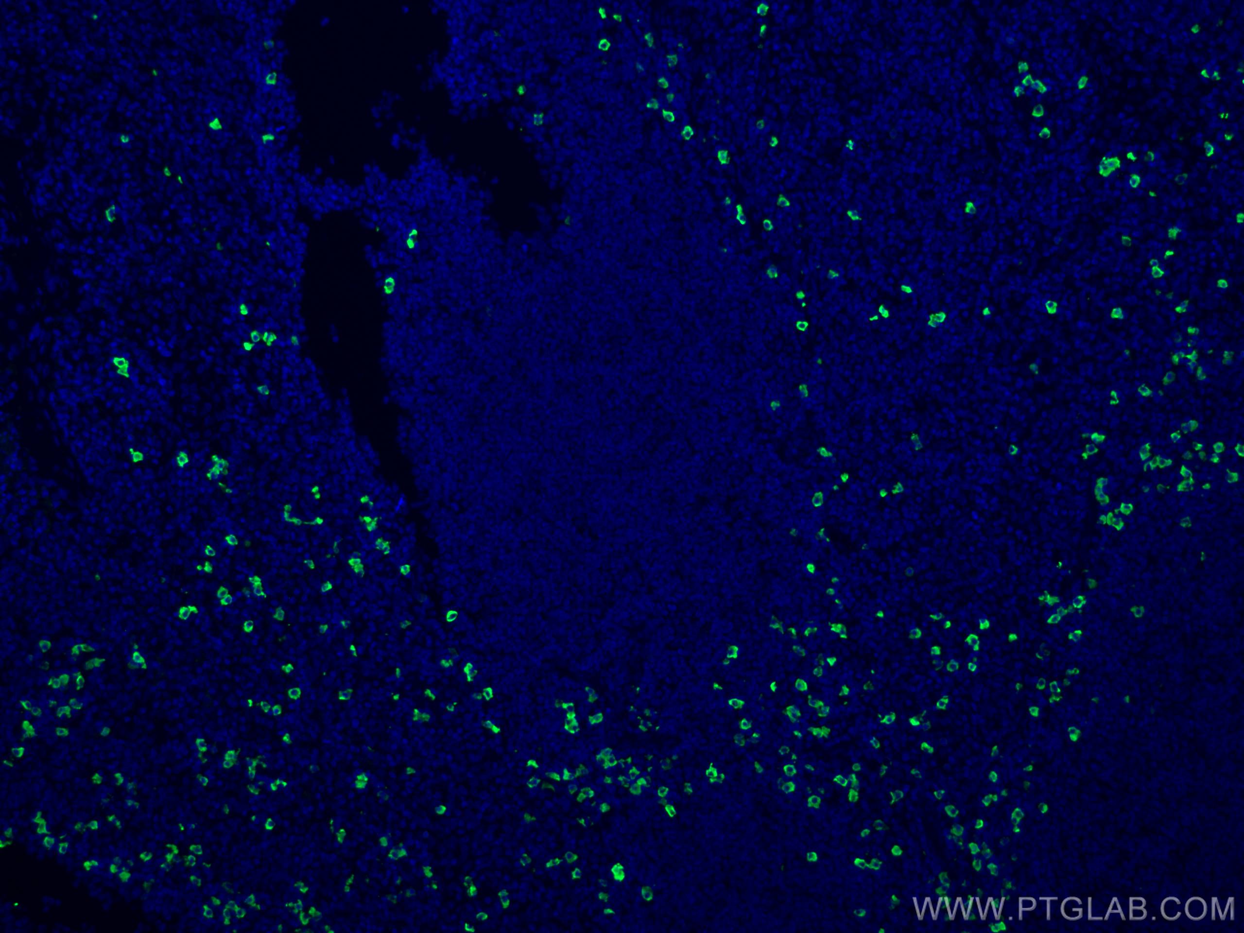 IF Staining of human tonsillitis using CL488-11449