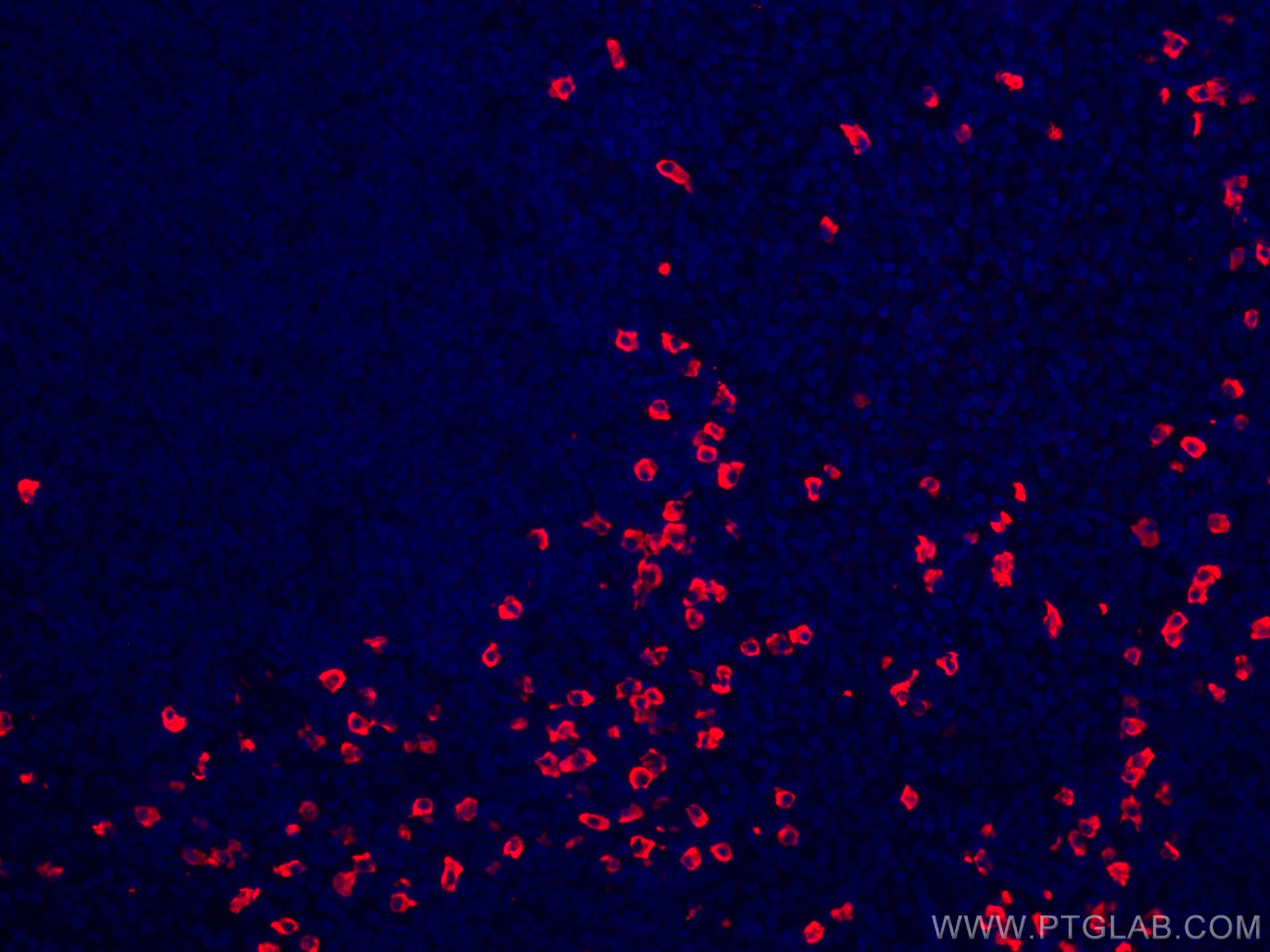 IF Staining of human tonsillitis using CL594-11449
