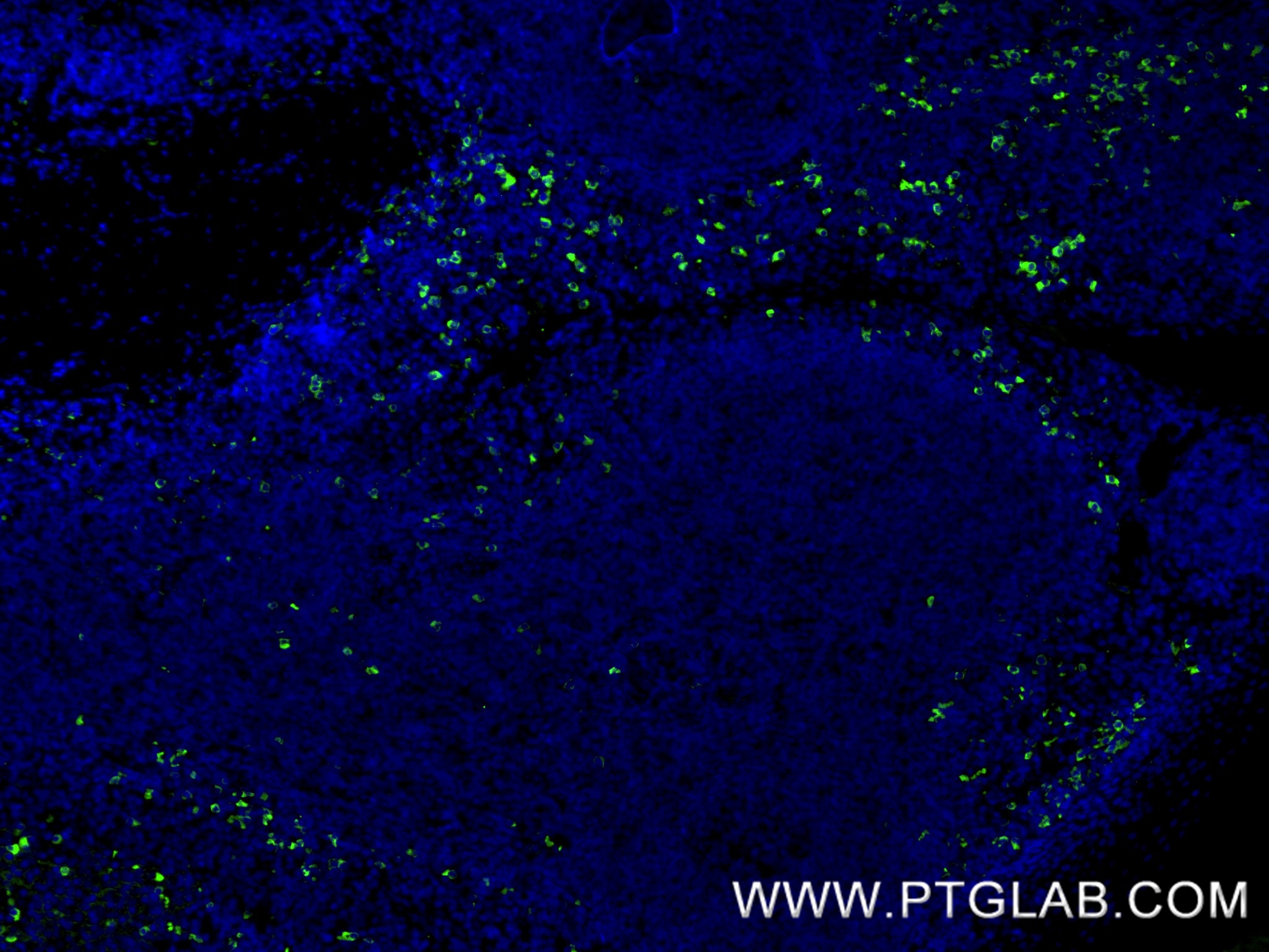 IF Staining of human tonsillitis using 87606-3-RR IF Staining of human tonsillitis using 87606-3-RR