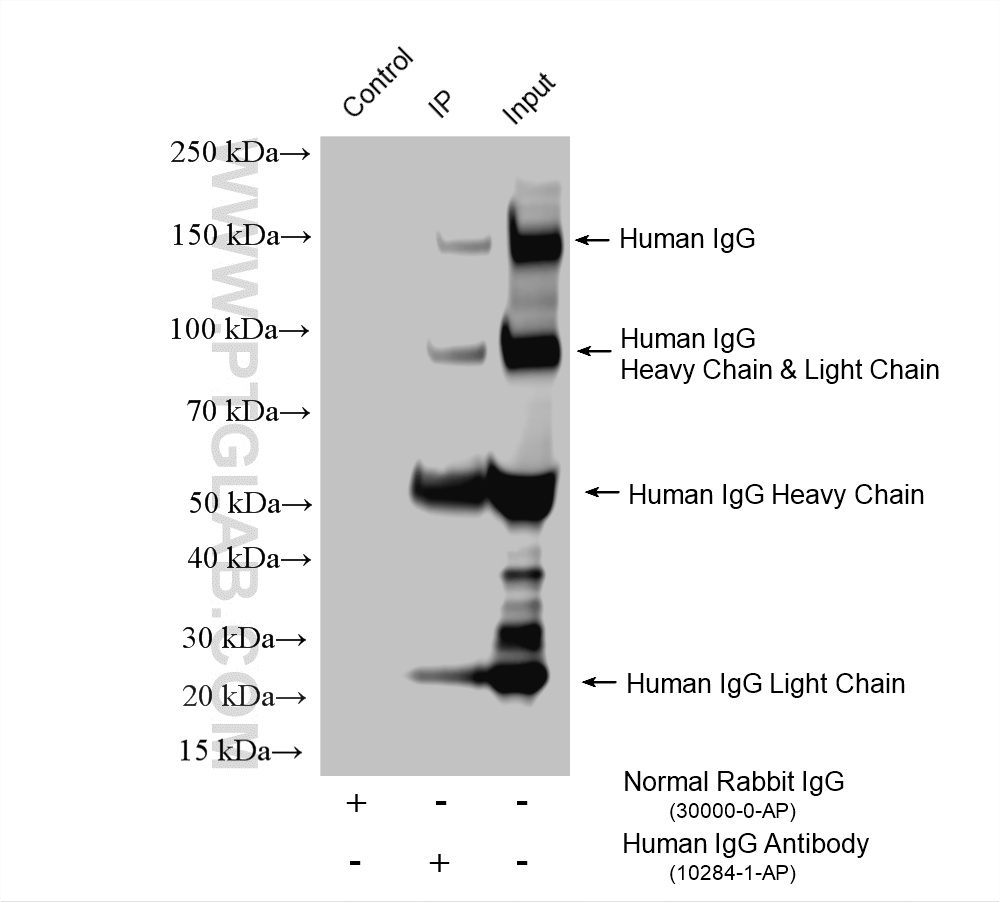 IP experiment of human plasma using 10284-1-AP