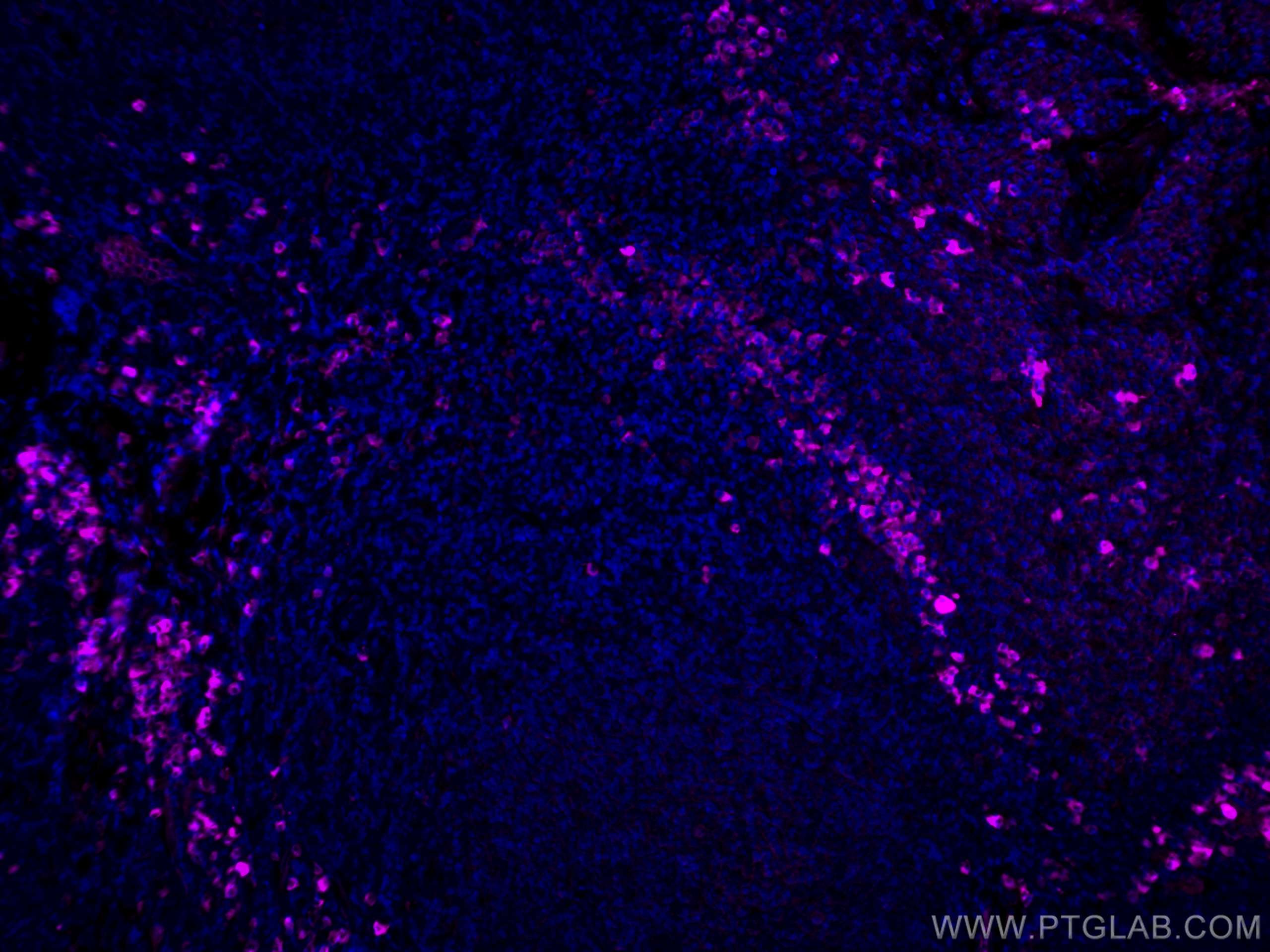 IF Staining of human tonsillitis using CL647-10284