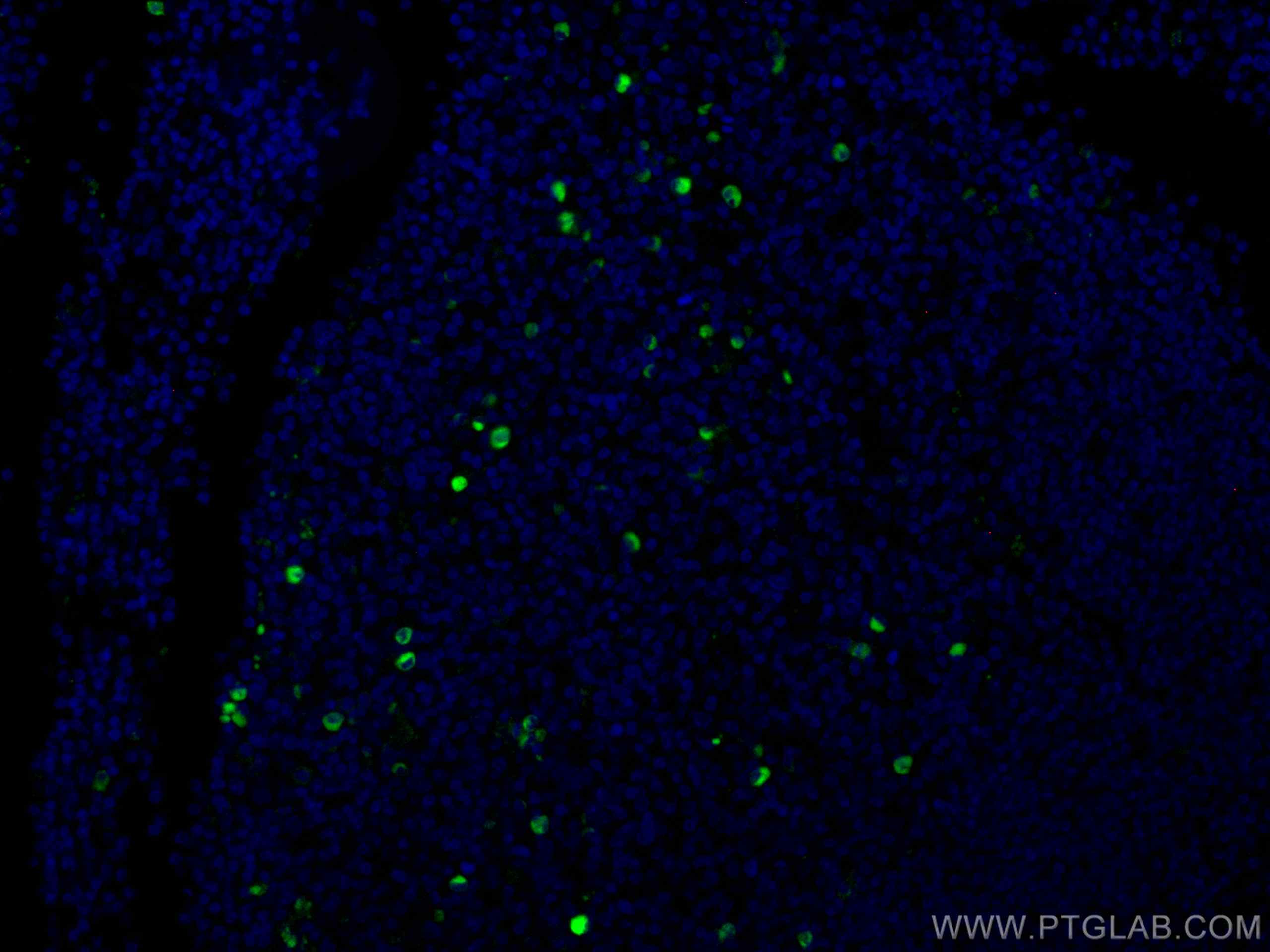 IF Staining of human tonsillitis using CL488-67760