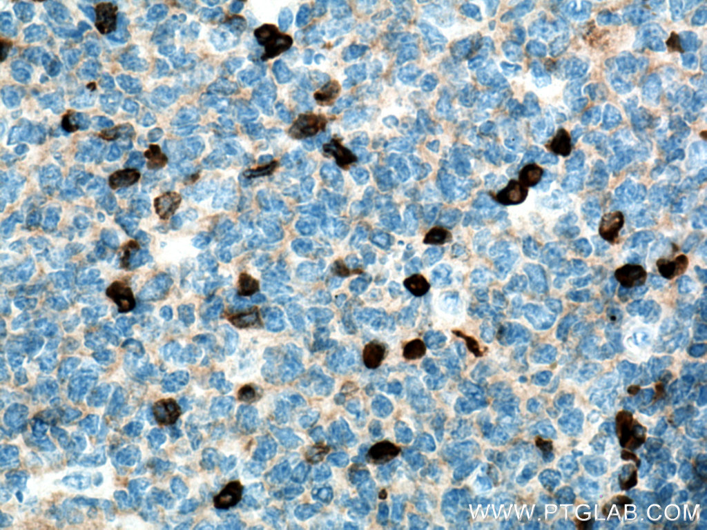 Human igg lambda chain antibody 67762 1 ig proteintech 