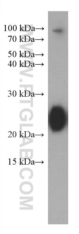 WB analysis of human plasma using 67762-1-Ig