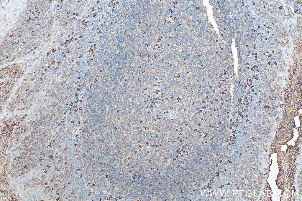 IHC staining of human tonsillitis using Biotin-67762