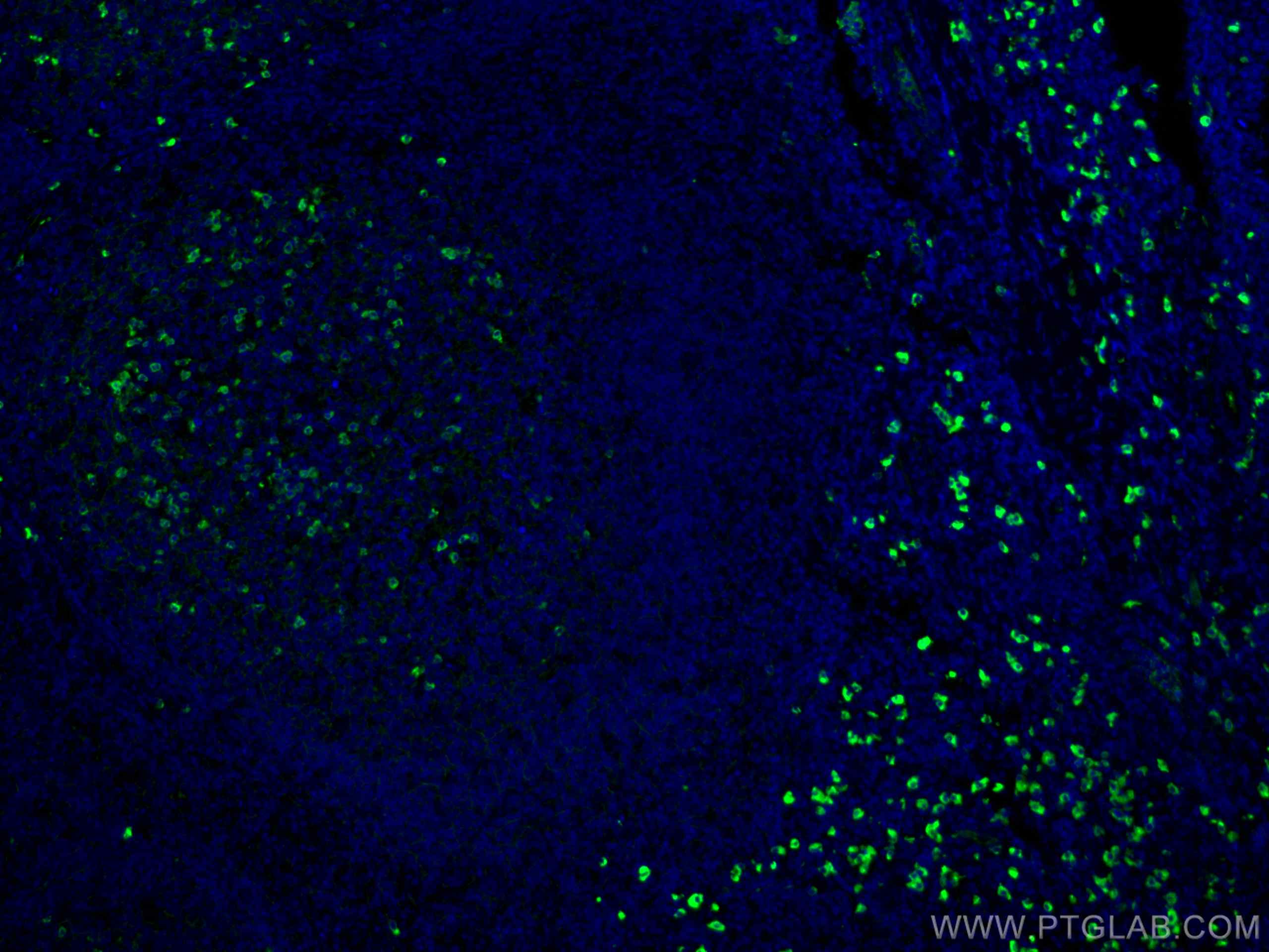 IF Staining of human tonsillitis using CL488-67762