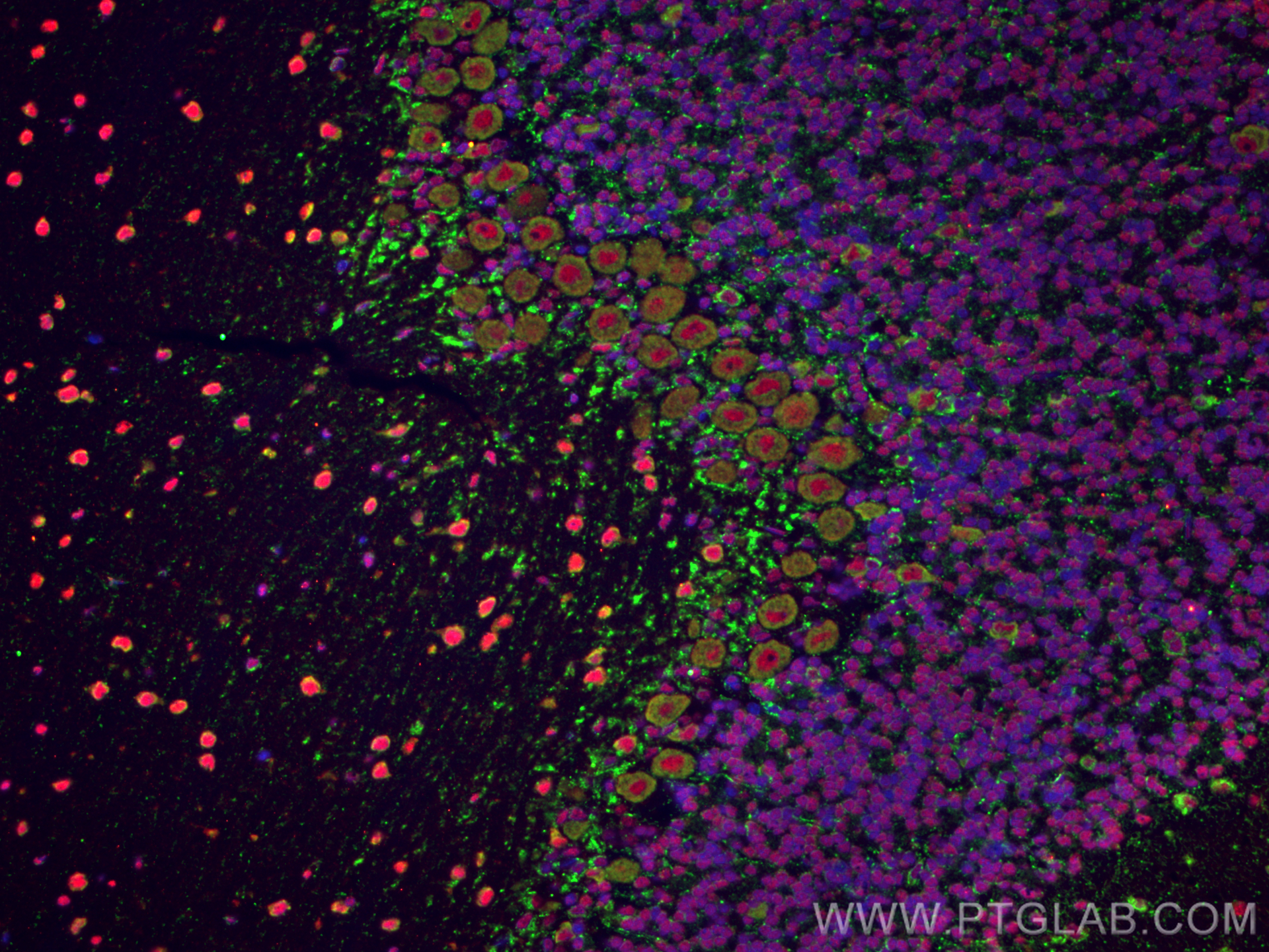IF Staining of rat cerebellum using 27206-1-AP