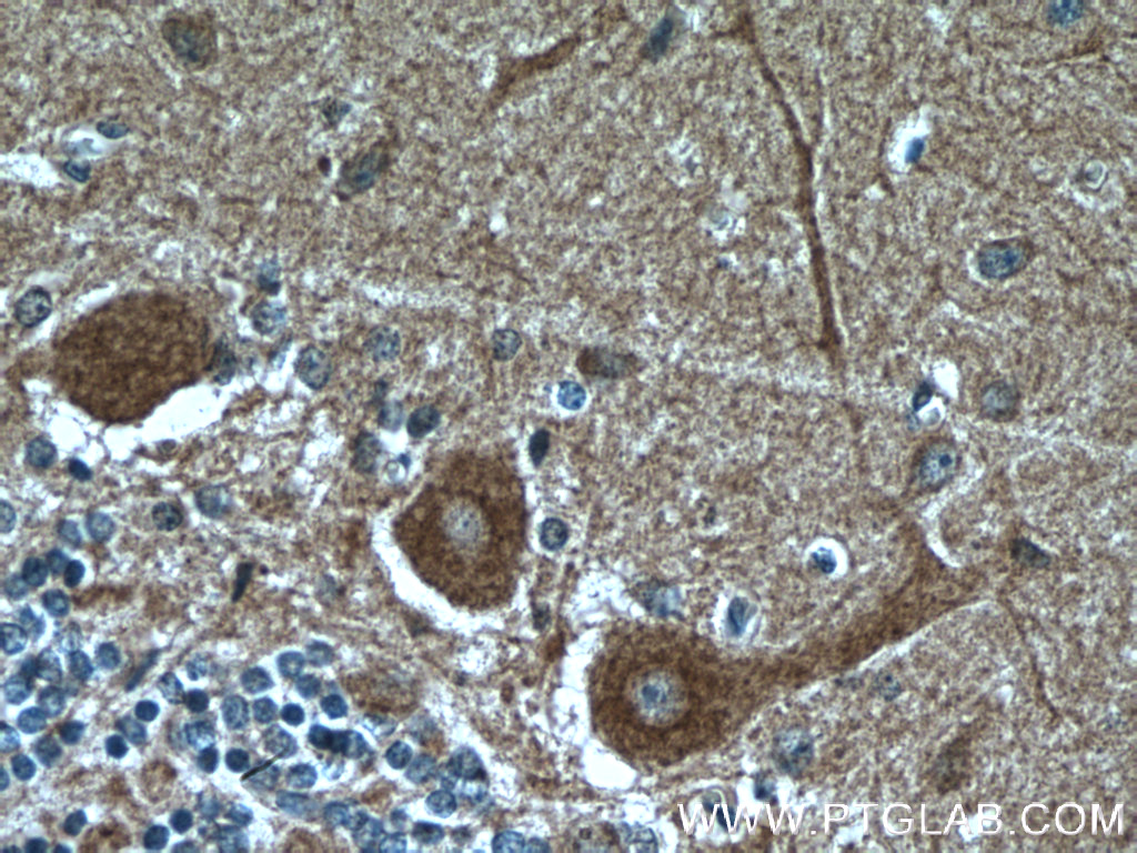 IHC staining of human cerebellum using 66553-1-Ig