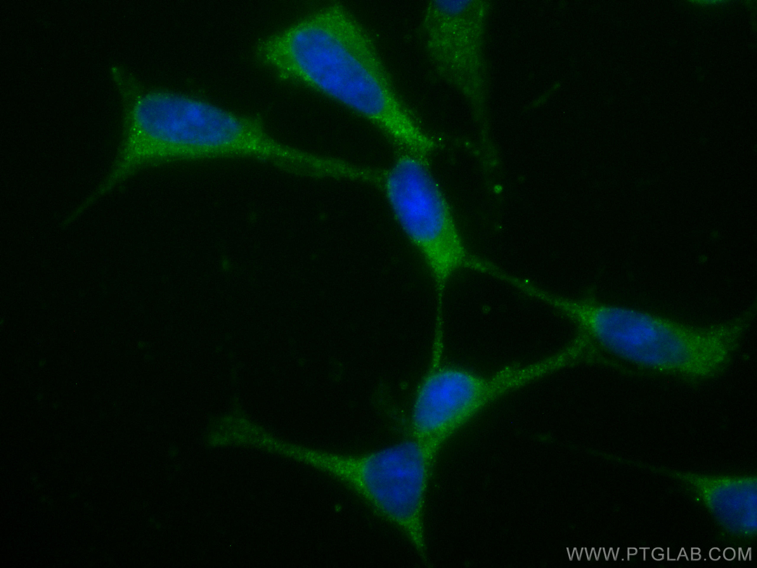 IF Staining of SH-SY5Y using CL488-27206