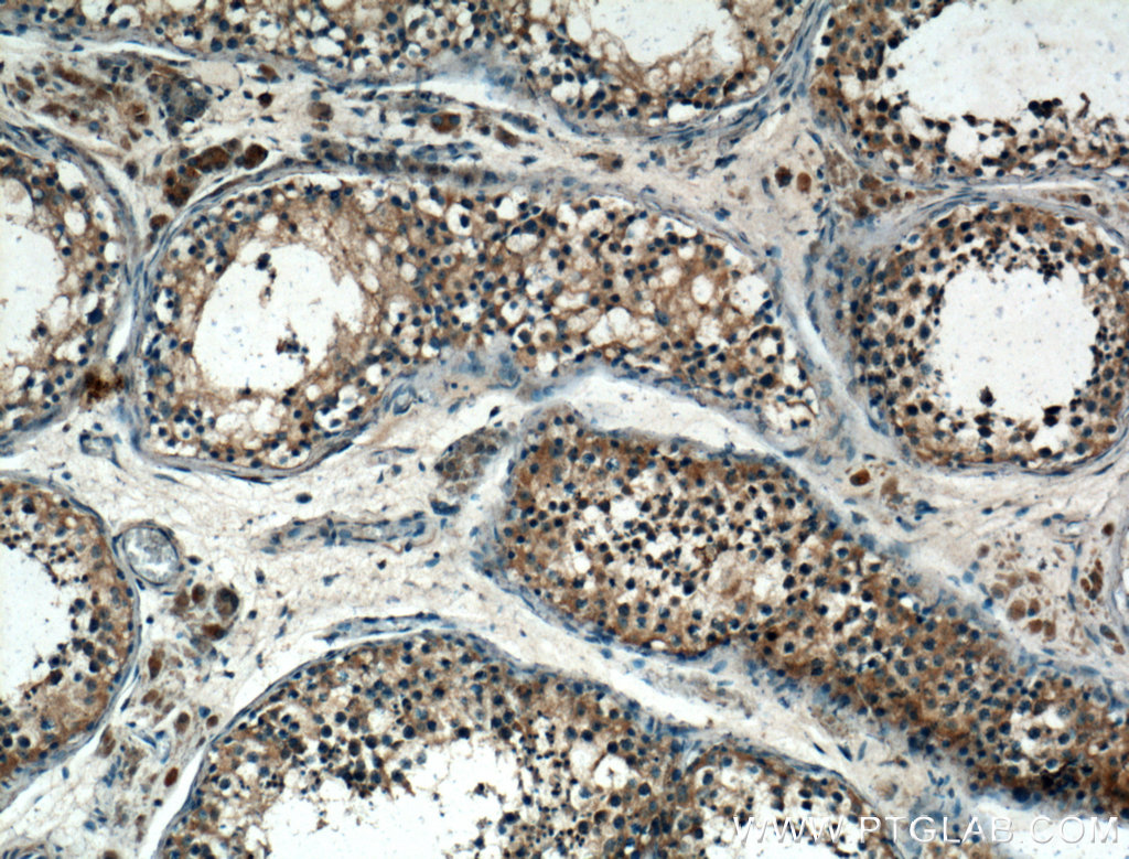 IHC staining of human testis using 26942-1-AP