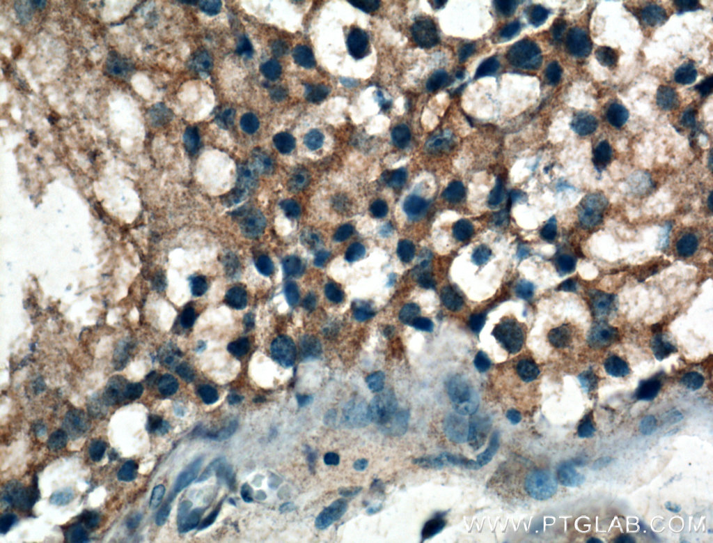 IHC staining of human testis using 26942-1-AP