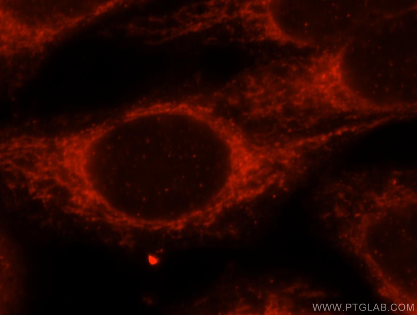 IF Staining of HepG2 using 17170-1-AP