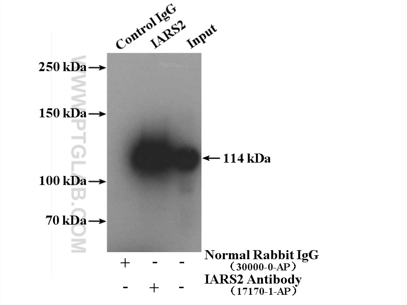 IP experiment of HeLa using 17170-1-AP