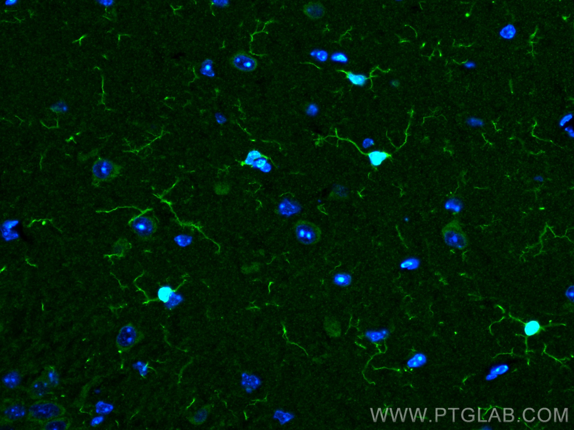 IF Staining of mouse brain using 10904-1-AP