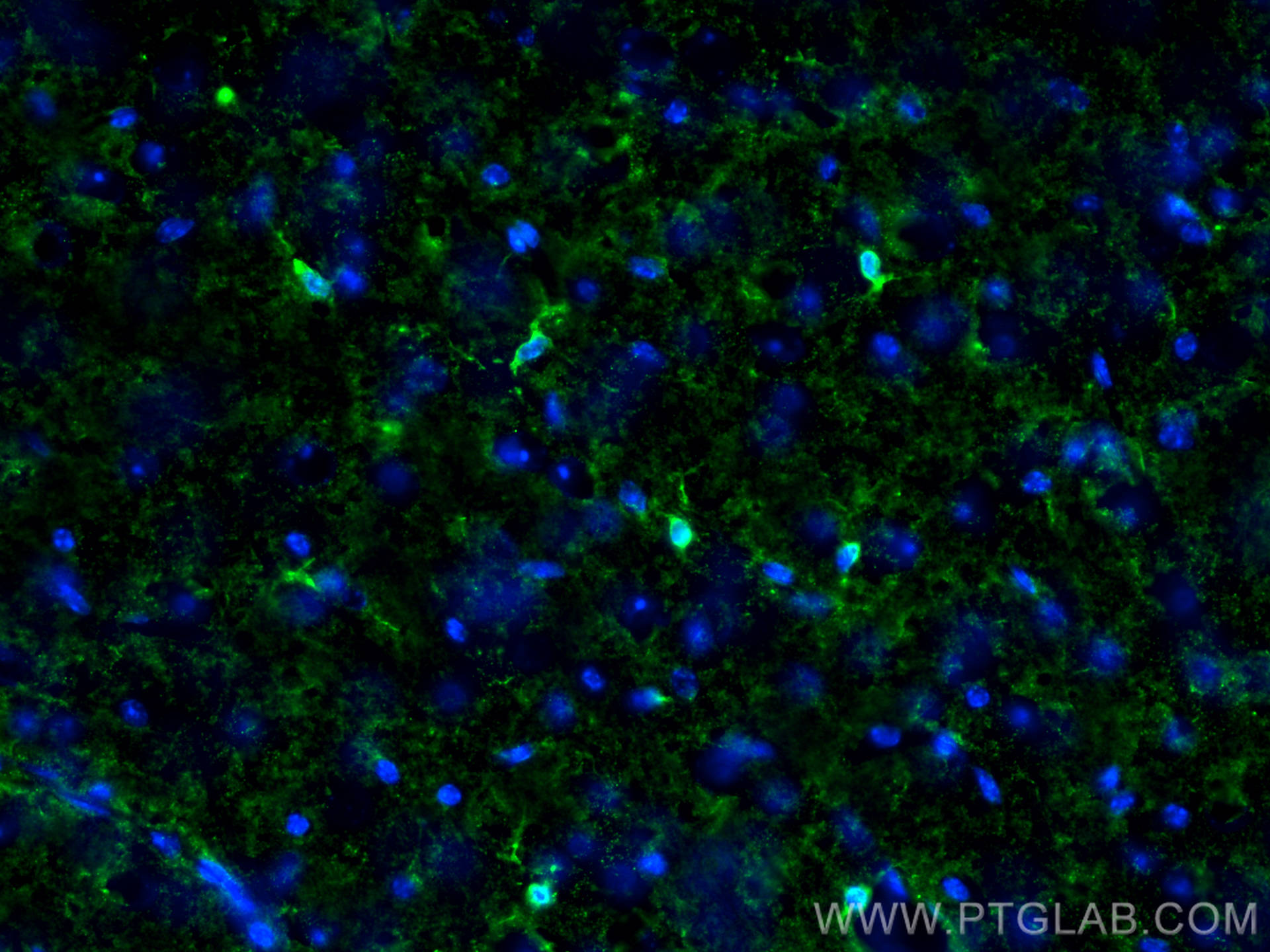 IF Staining of mouse brain using 10904-1-AP
