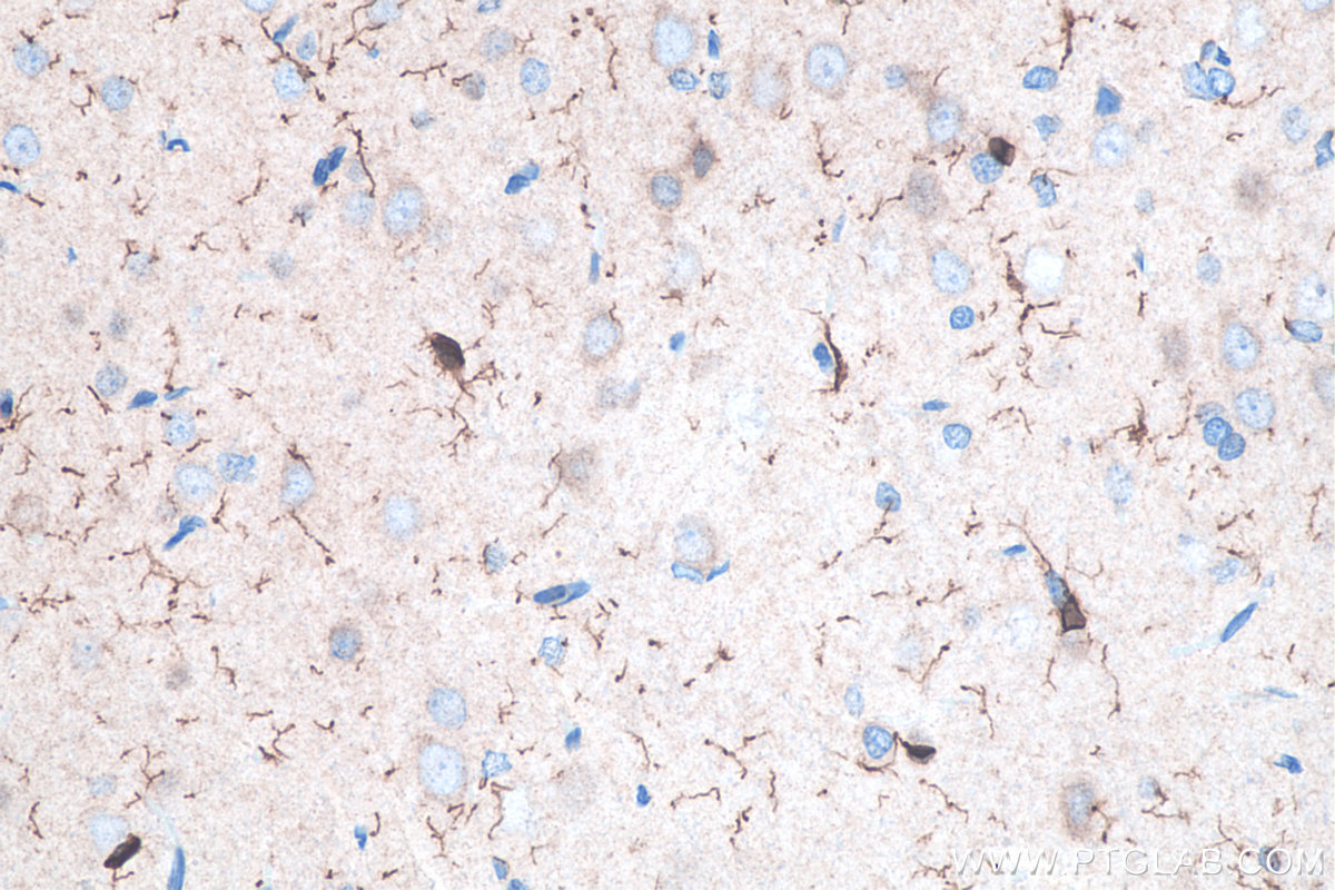 IHC staining of rat brain using 10904-1-AP IHC staining of rat brain using 10904-1-AP