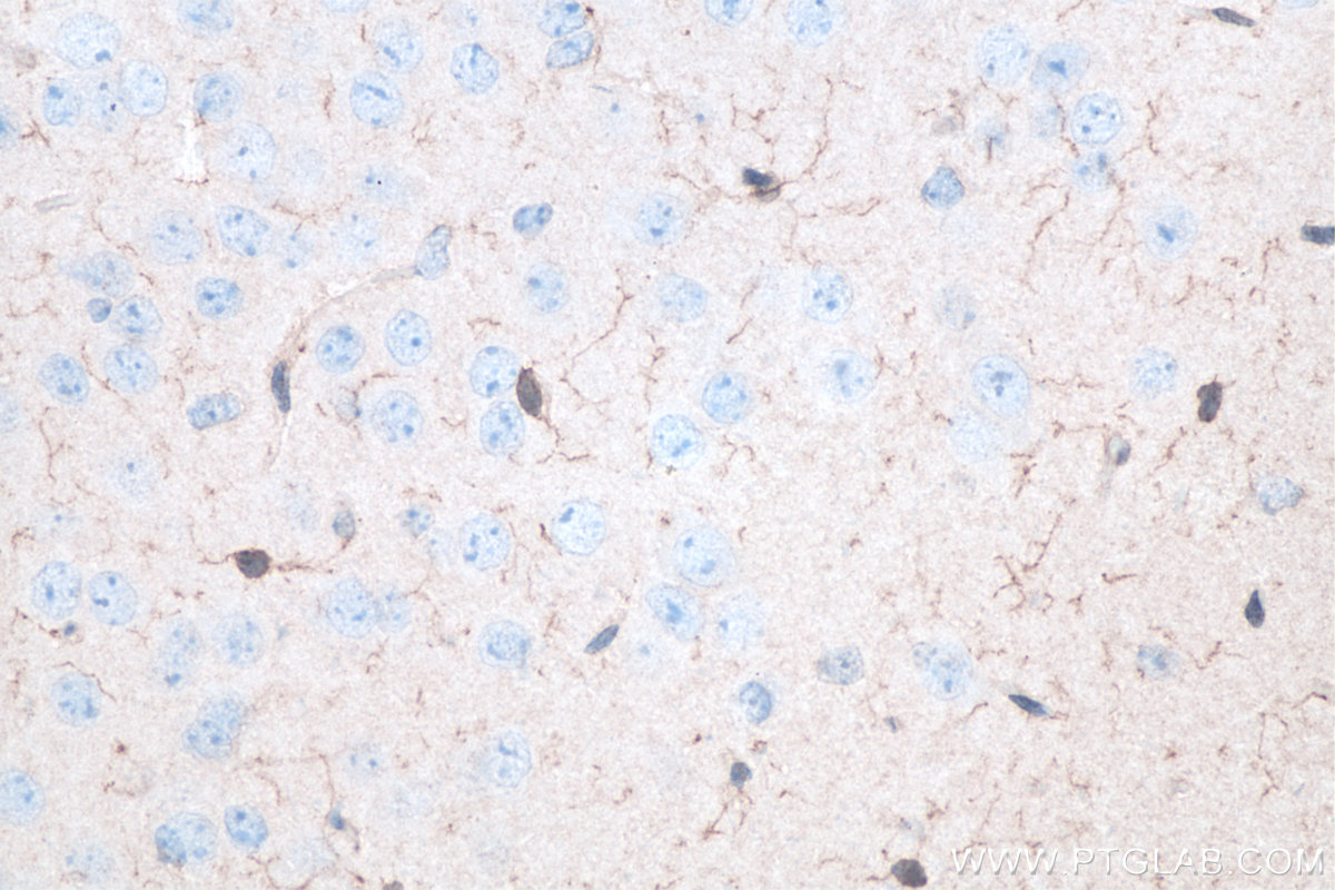 IHC staining of mouse brain using 10904-1-AP IHC staining of mouse brain using 10904-1-AP