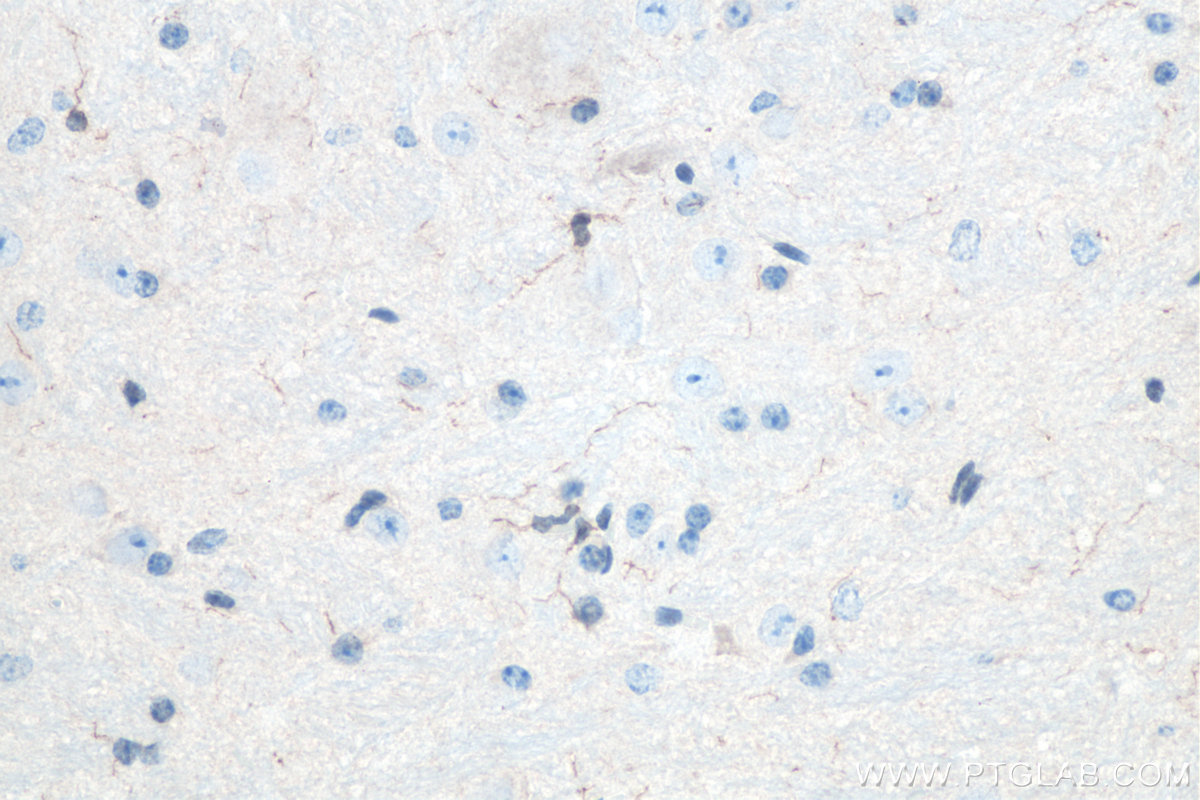 IHC staining of mouse cerebellum using 10904-1-AP IHC staining of mouse cerebellum using 10904-1-AP