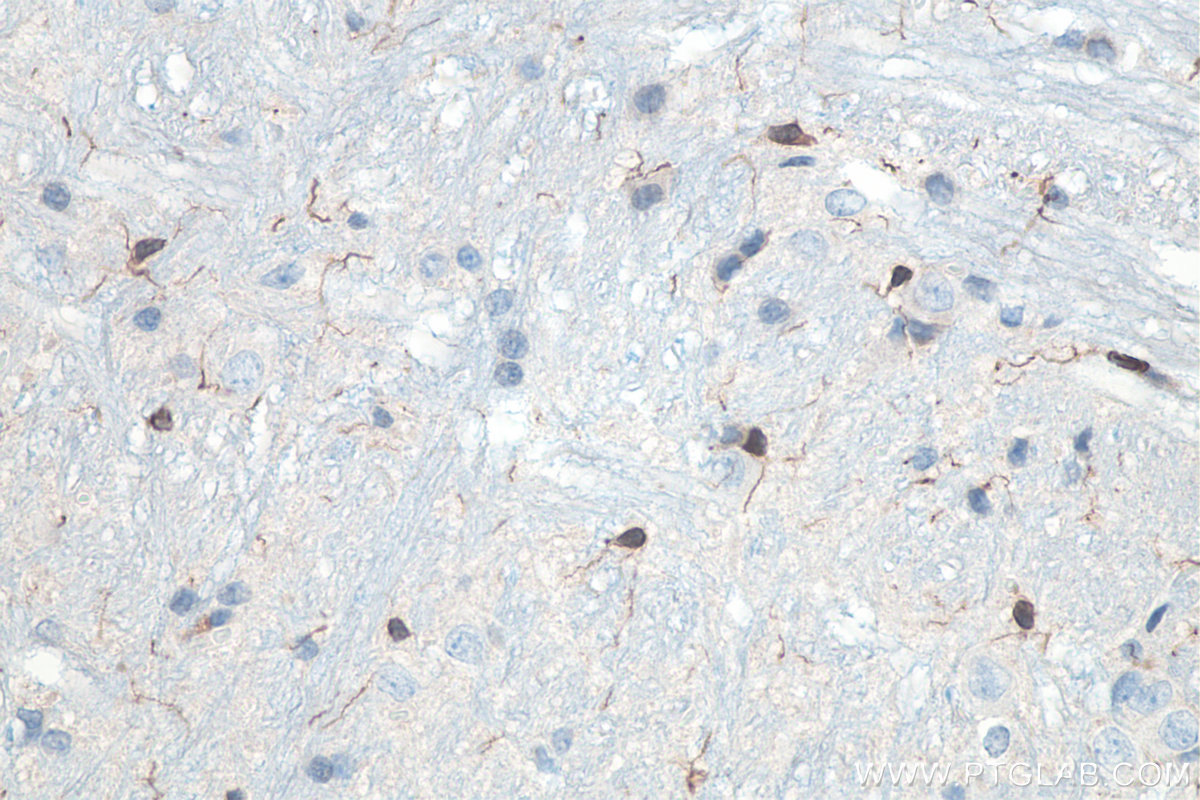 IHC staining of rat cerebellum using 10904-1-AP IHC staining of rat cerebellum using 10904-1-AP