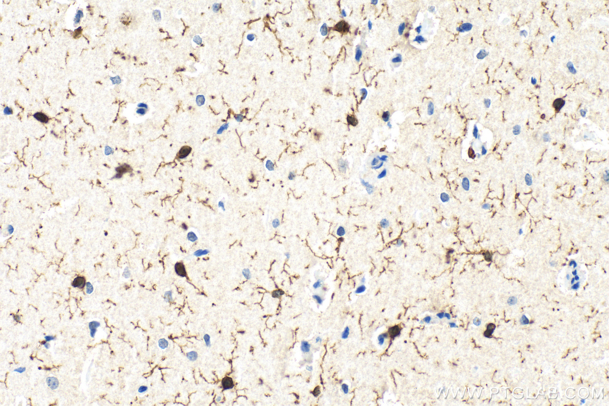 IHC staining of rat brain using 10904-1-AP