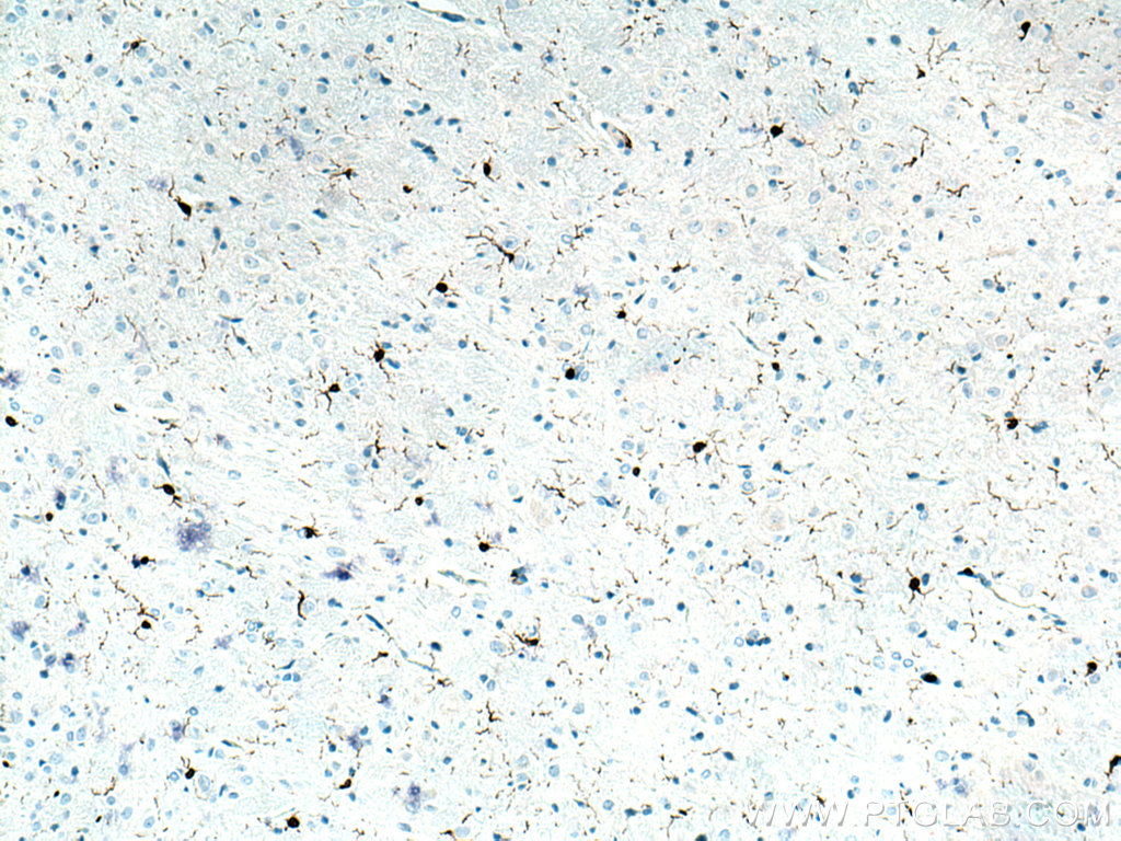 IHC staining of rat brain using 26177-1-AP