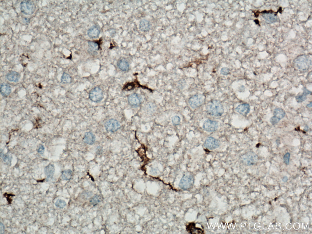 IHC staining of human brain using 66827-1-Ig