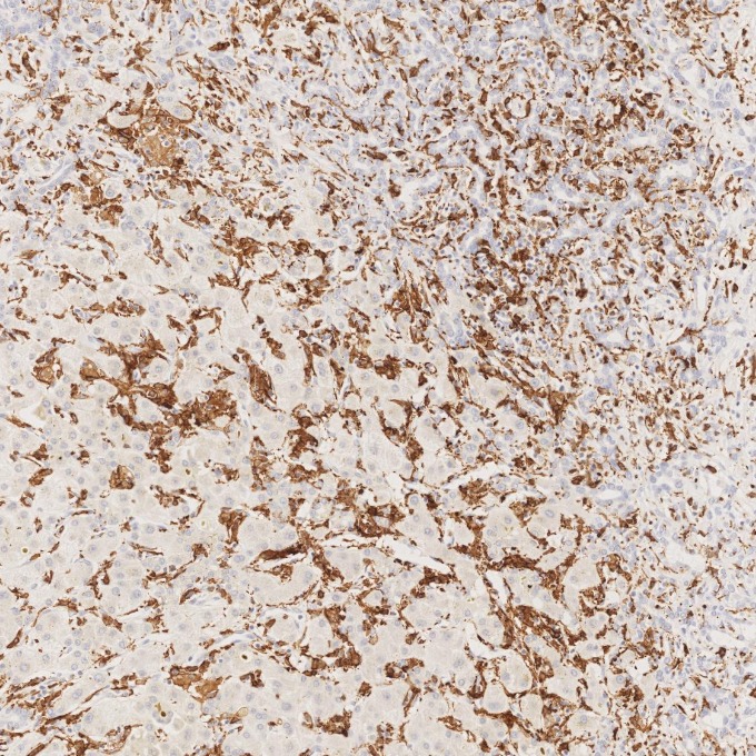 IHC staining of human liver using 66827-1-Ig
